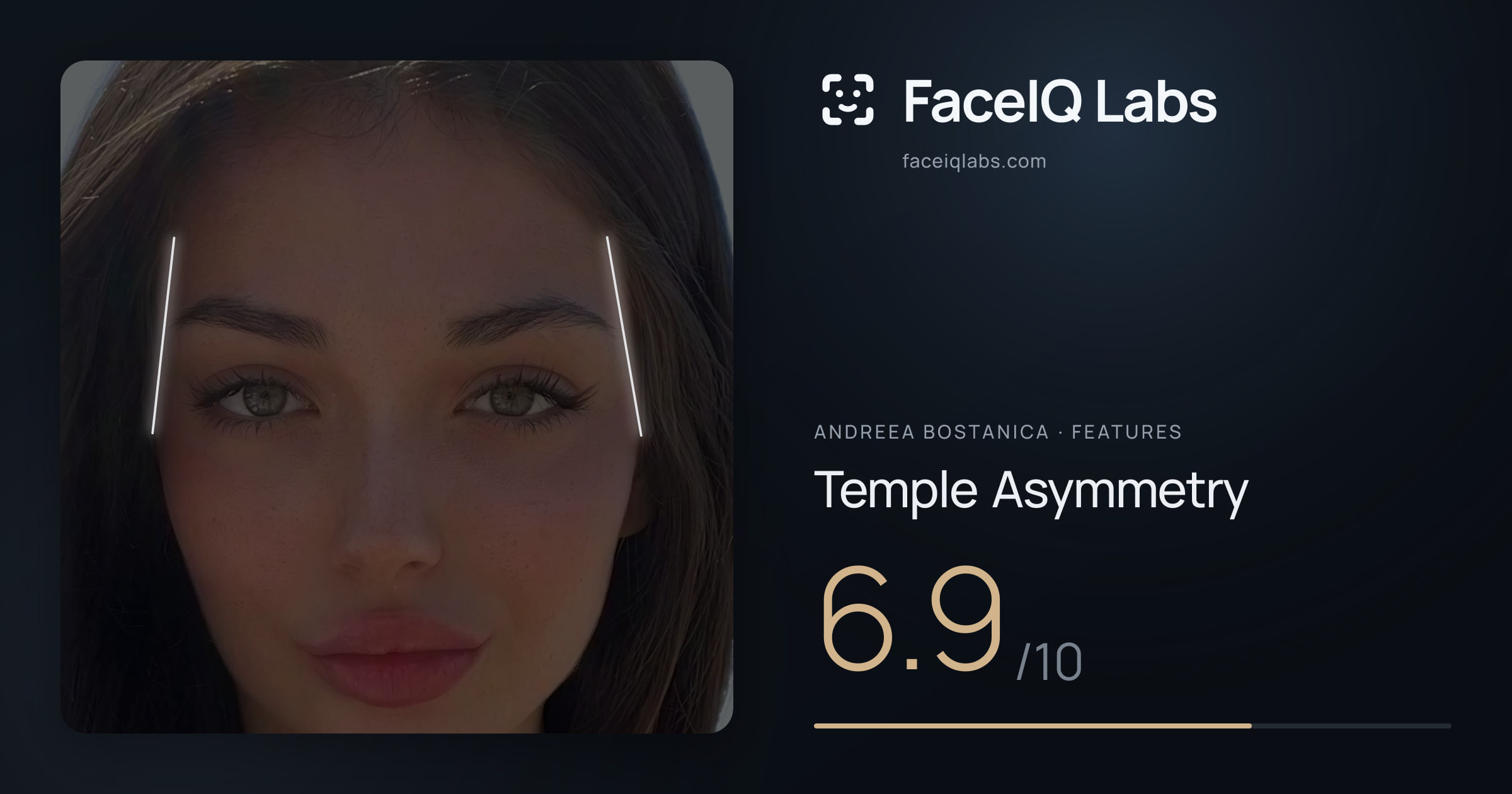 Andreea Bostanica Temple Asymmetry: 6.9/10, drawn on the photo
