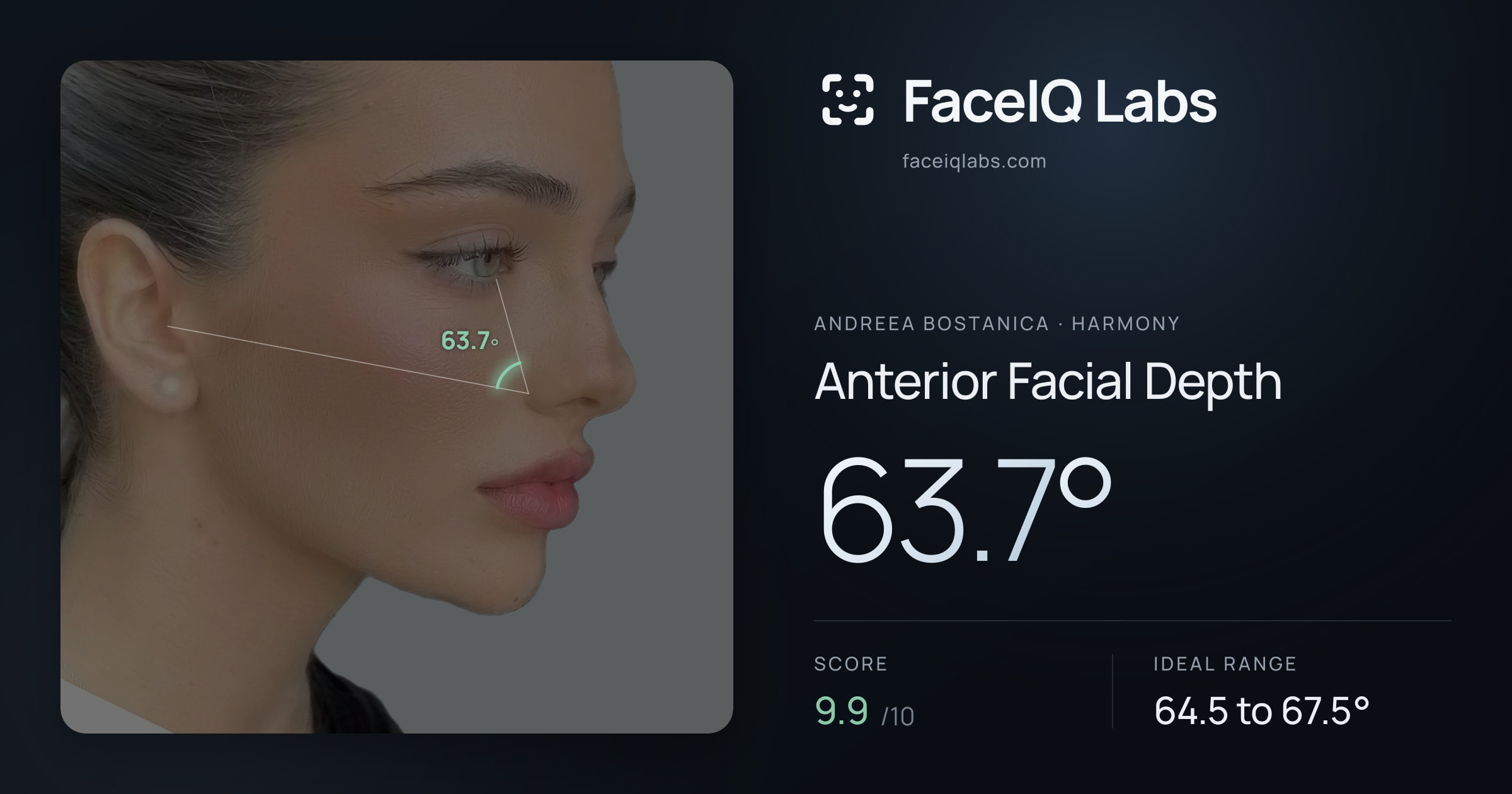 Andreea Bostanica Anterior Facial Depth: 63.7°, drawn on the photo