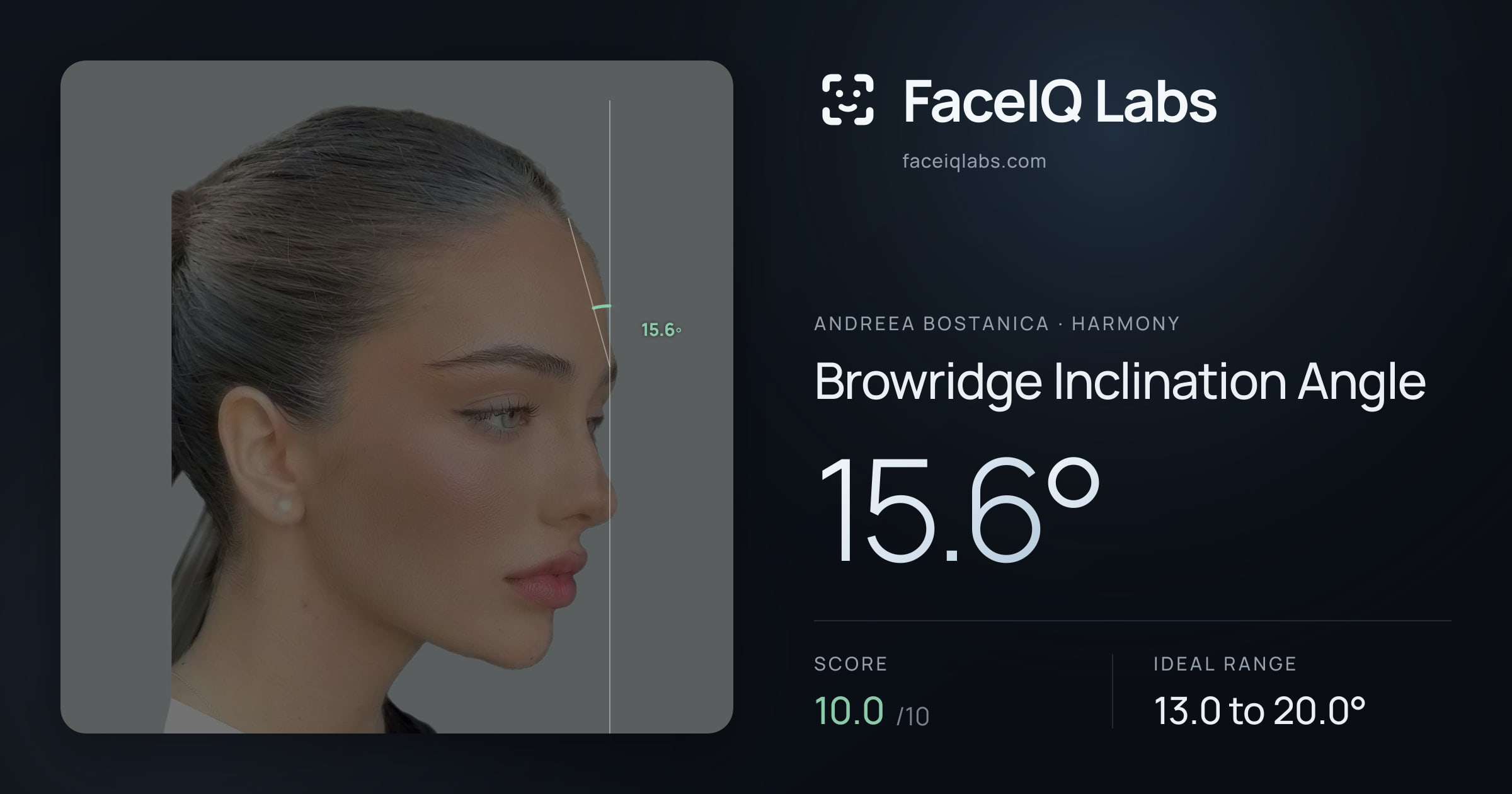 Andreea Bostanica Browridge Inclination Angle: 15.6°, drawn on the photo