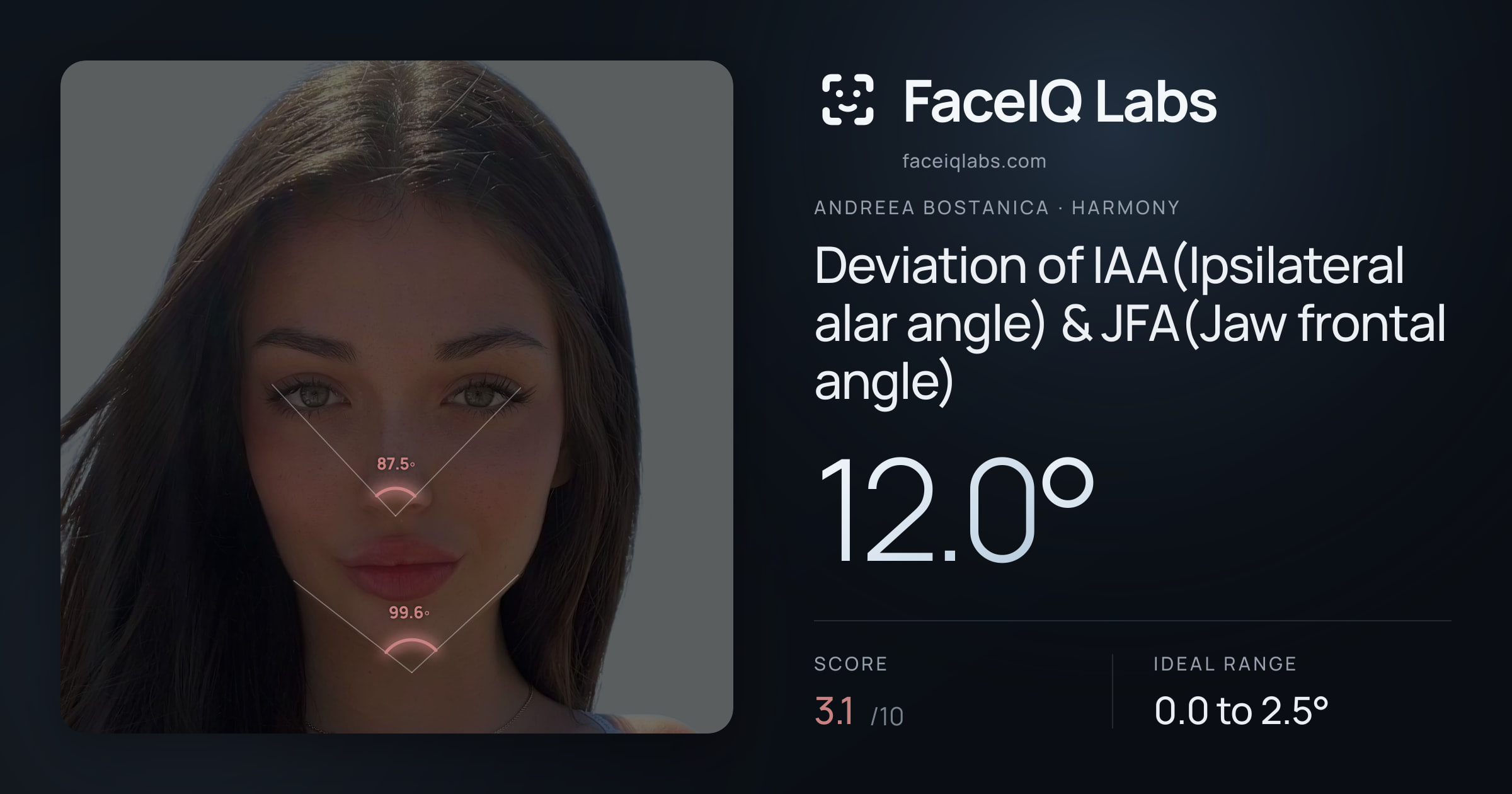 Andreea Bostanica Deviation of IAA(Ipsilateral alar angle) & JFA(Jaw frontal angle): 12.0°, drawn on the photo