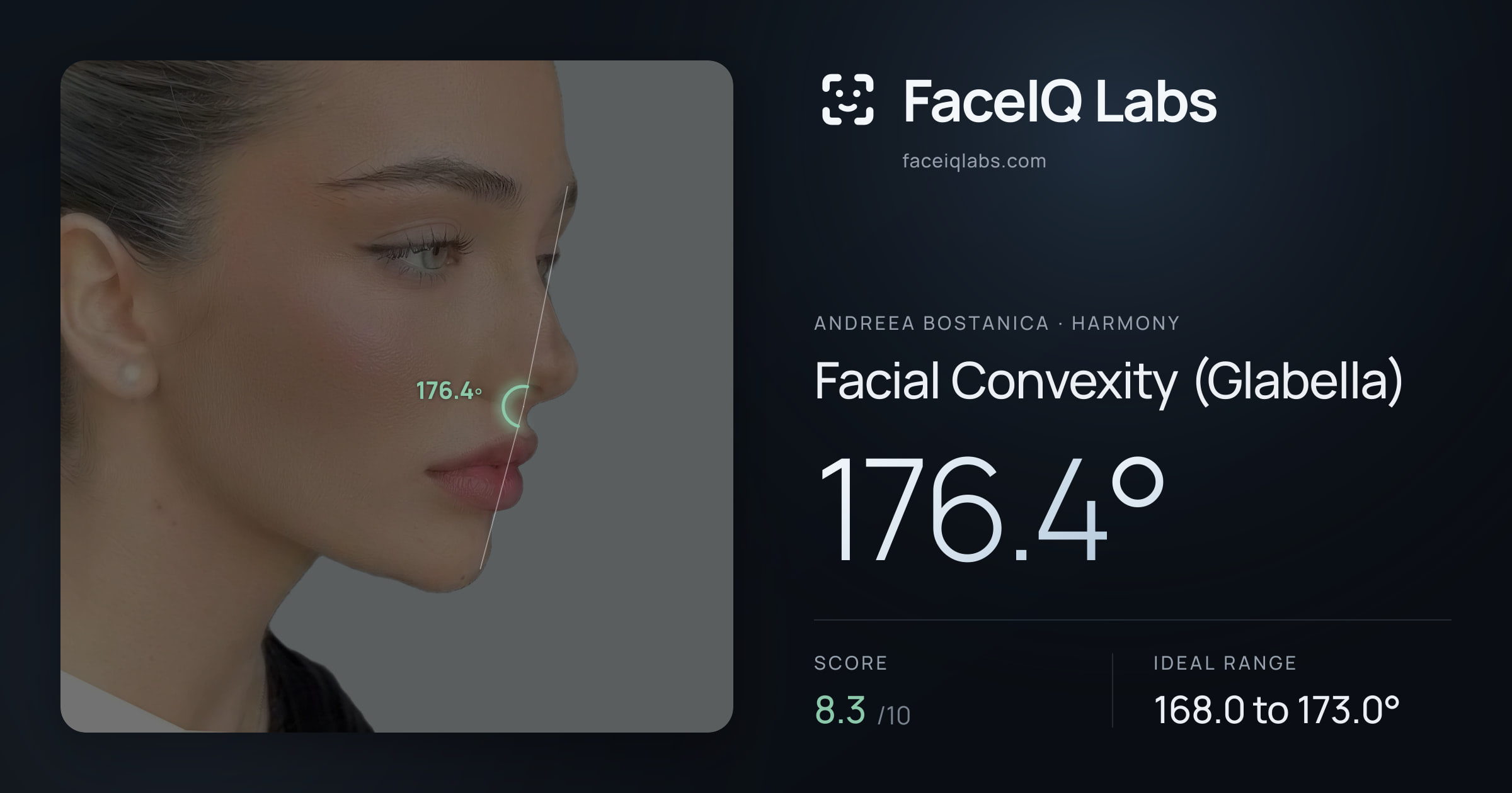 Andreea Bostanica Facial Convexity (Glabella): 176.4°, drawn on the photo