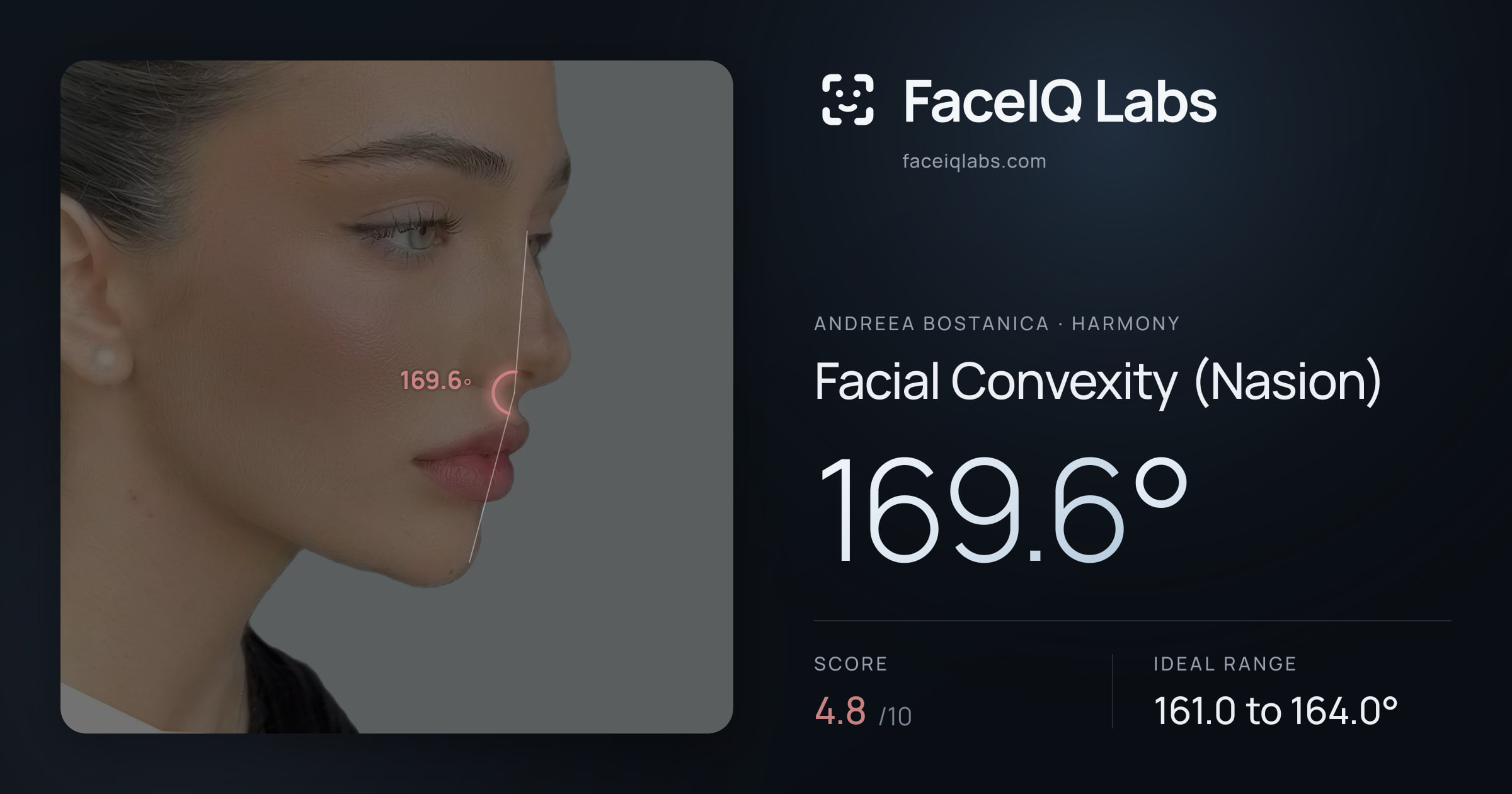 Andreea Bostanica Facial Convexity (Nasion): 169.6°, drawn on the photo