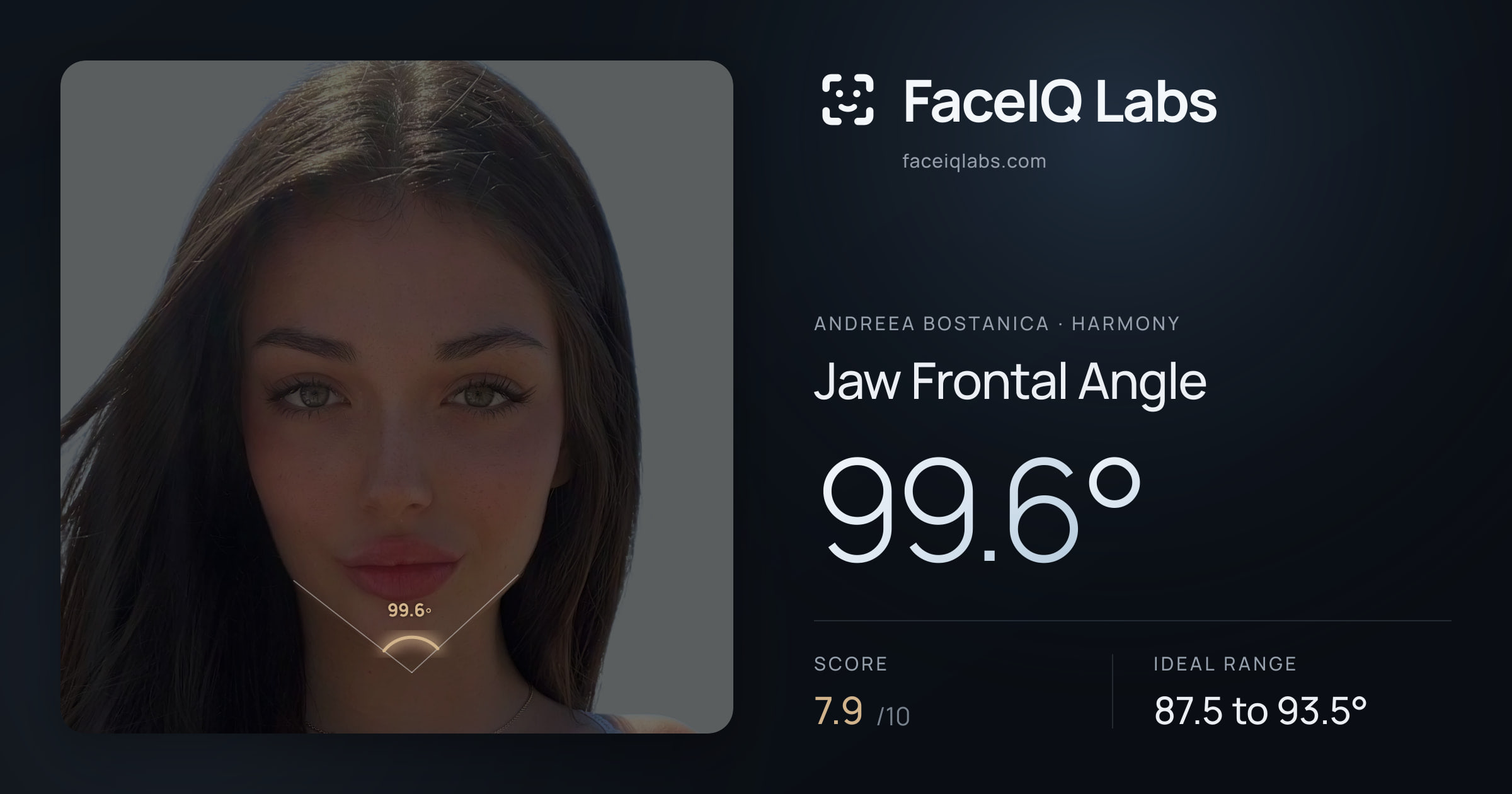 Andreea Bostanica Jaw Frontal Angle: 99.6°, drawn on the photo