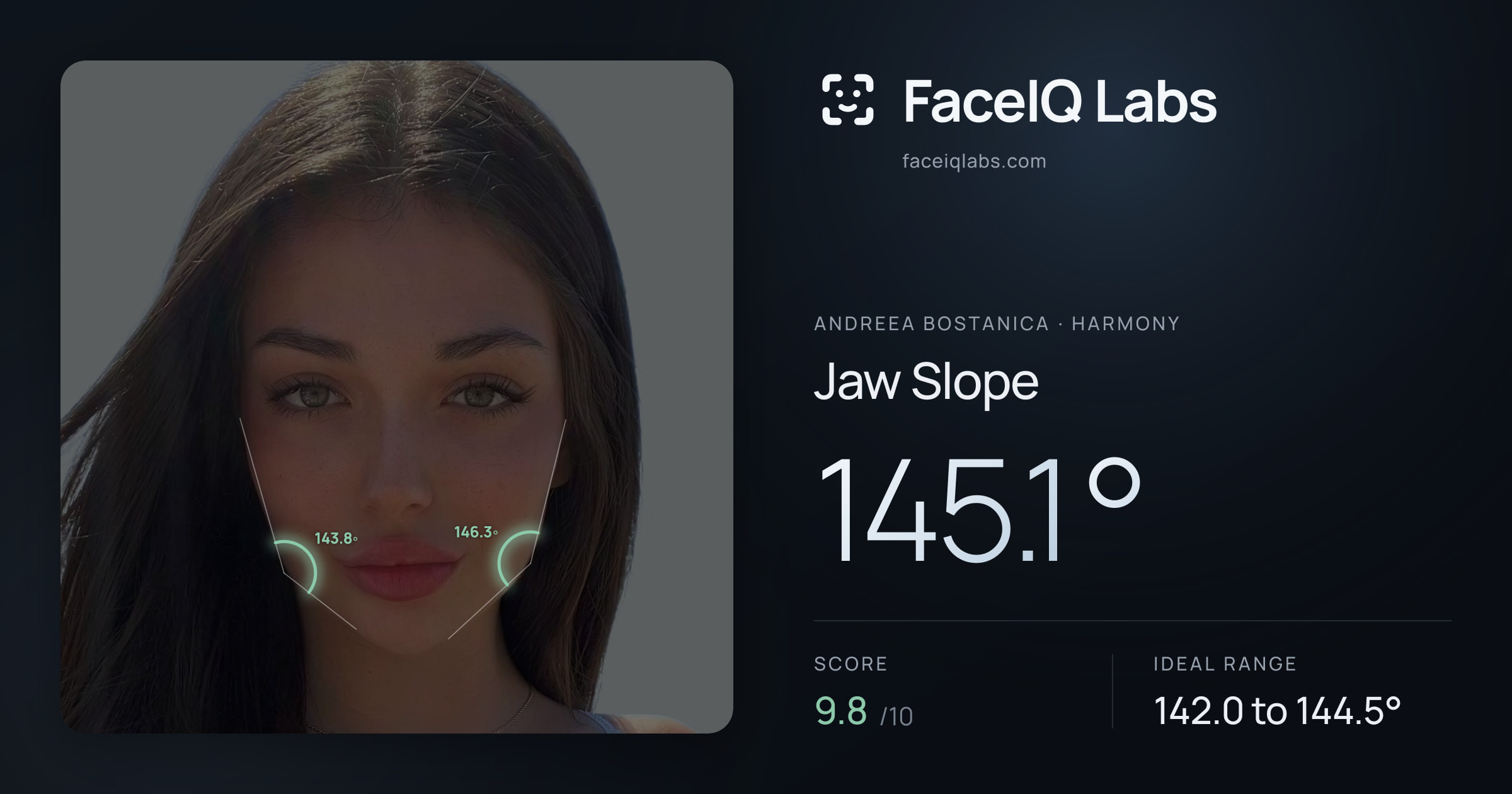 Andreea Bostanica Jaw Slope: 145.1°, drawn on the photo