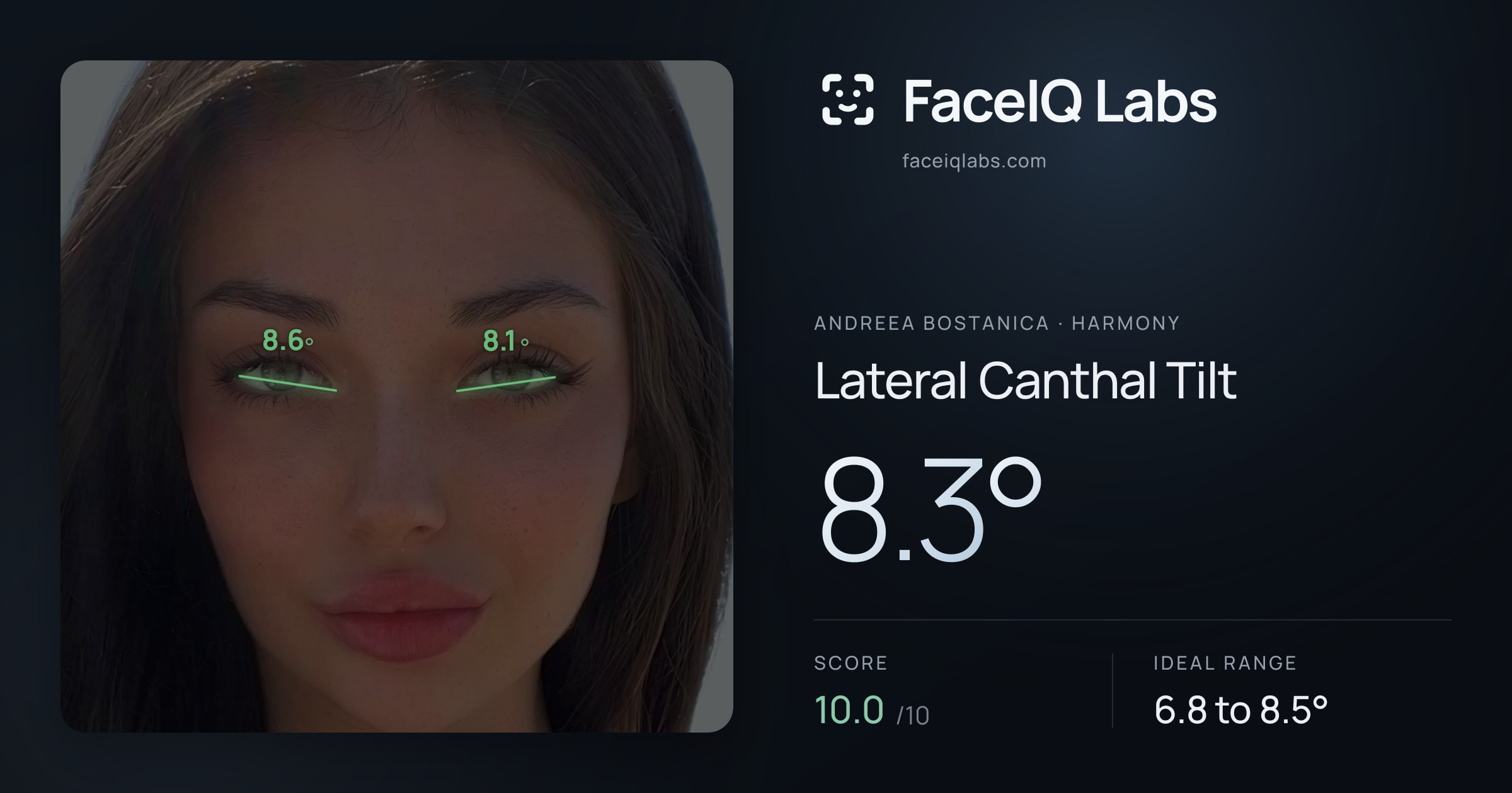 Andreea Bostanica Lateral Canthal Tilt: 8.3°, drawn on the photo