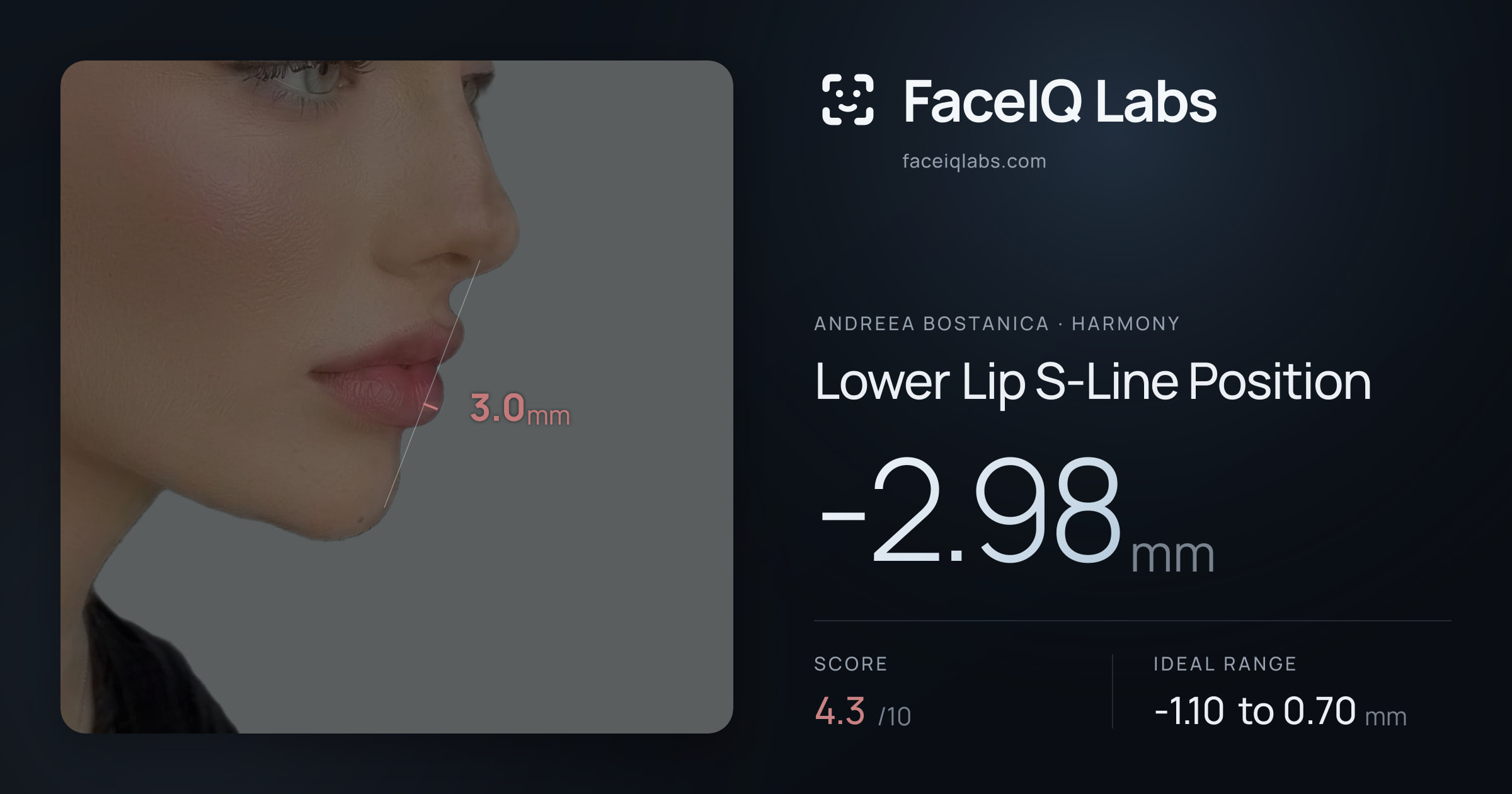 Andreea Bostanica Lower Lip S-Line Position: -2.98mm, drawn on the photo