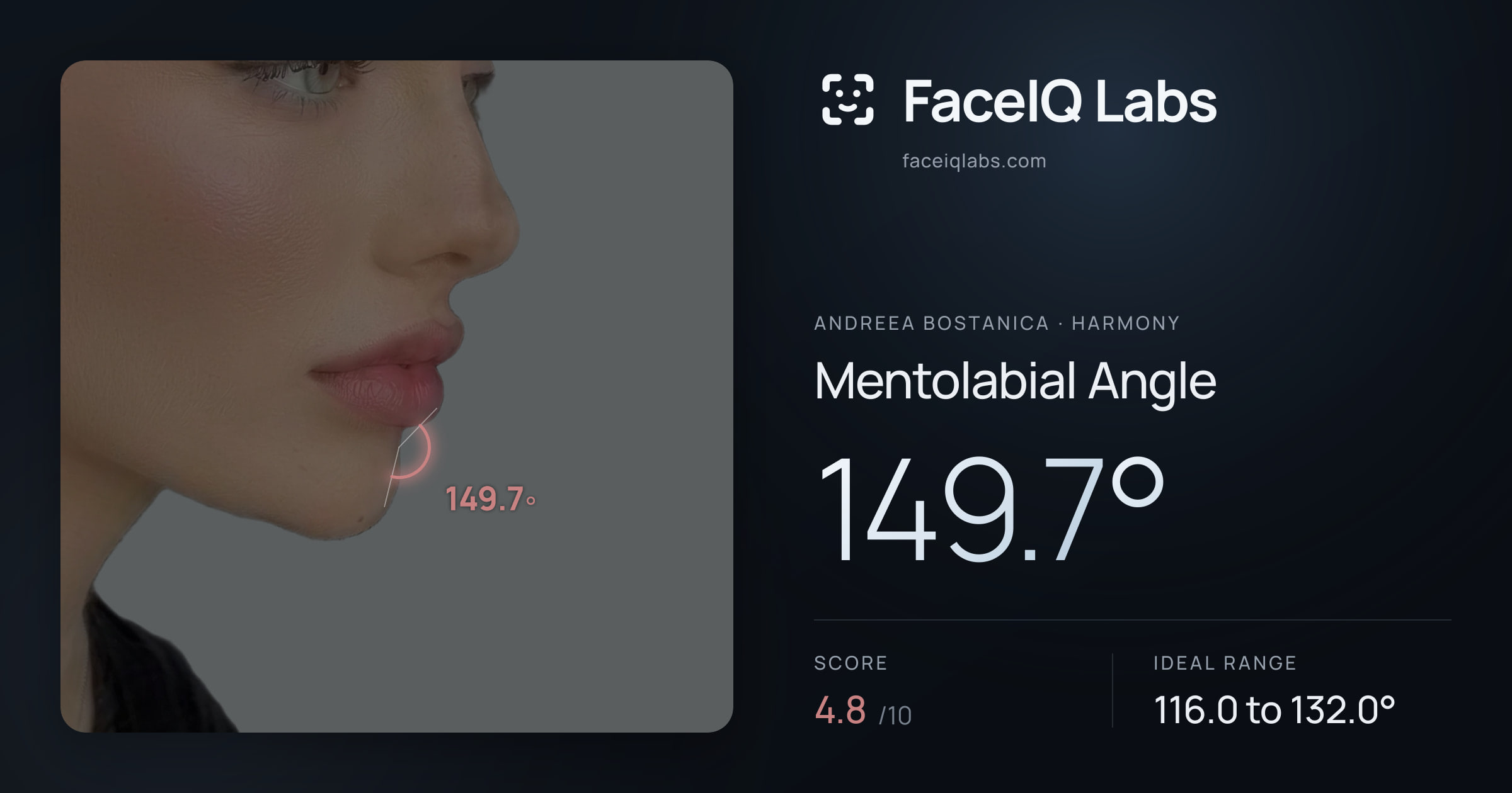 Andreea Bostanica Mentolabial Angle: 149.7°, drawn on the photo