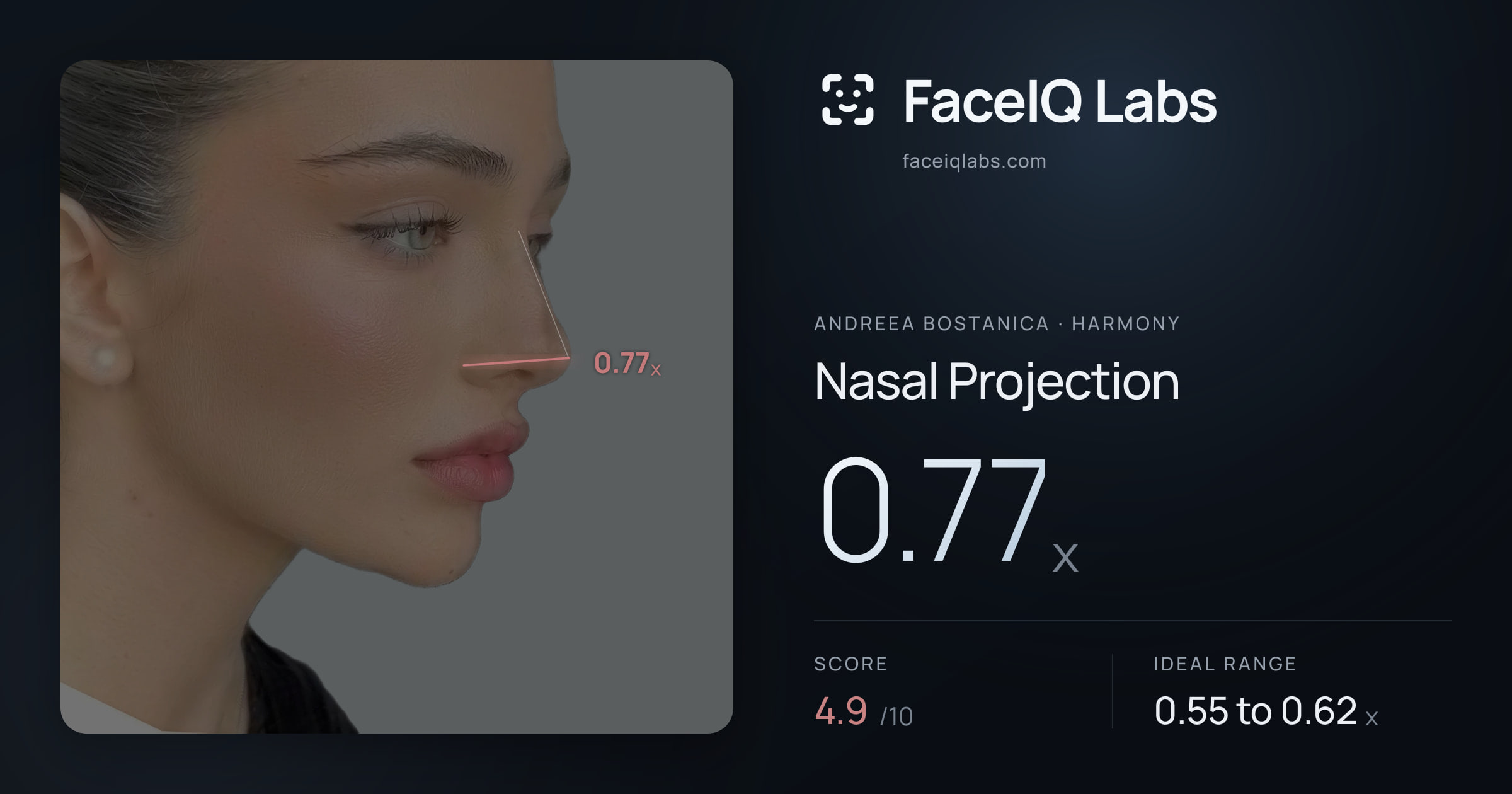 Andreea Bostanica Nasal Projection: 0.77x, drawn on the photo