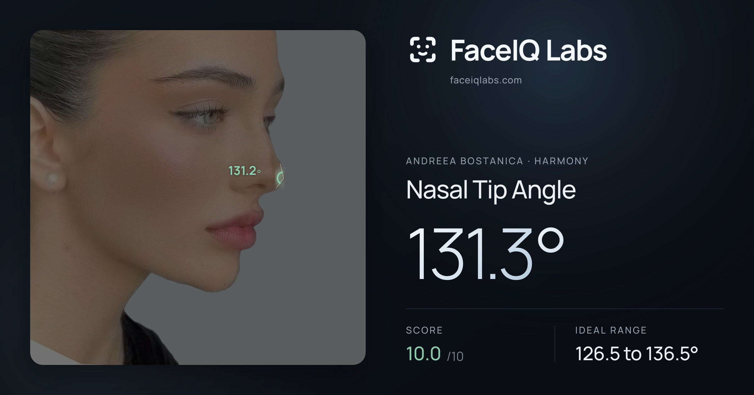 Andreea Bostanica Nasal Tip Angle: 131.3°, drawn on the photo