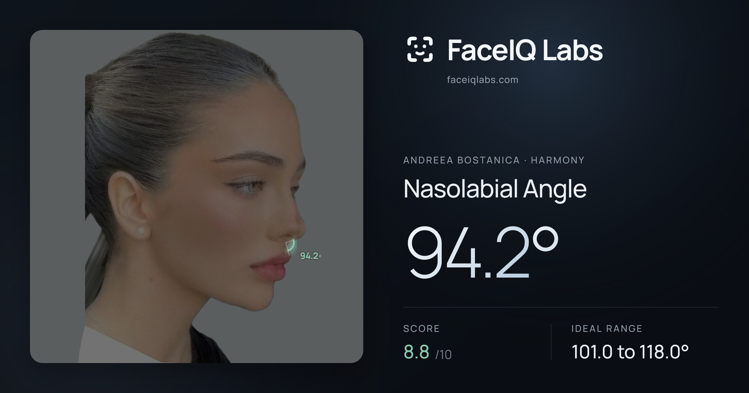 Andreea Bostanica Nasolabial Angle: 94.2°, drawn on the photo