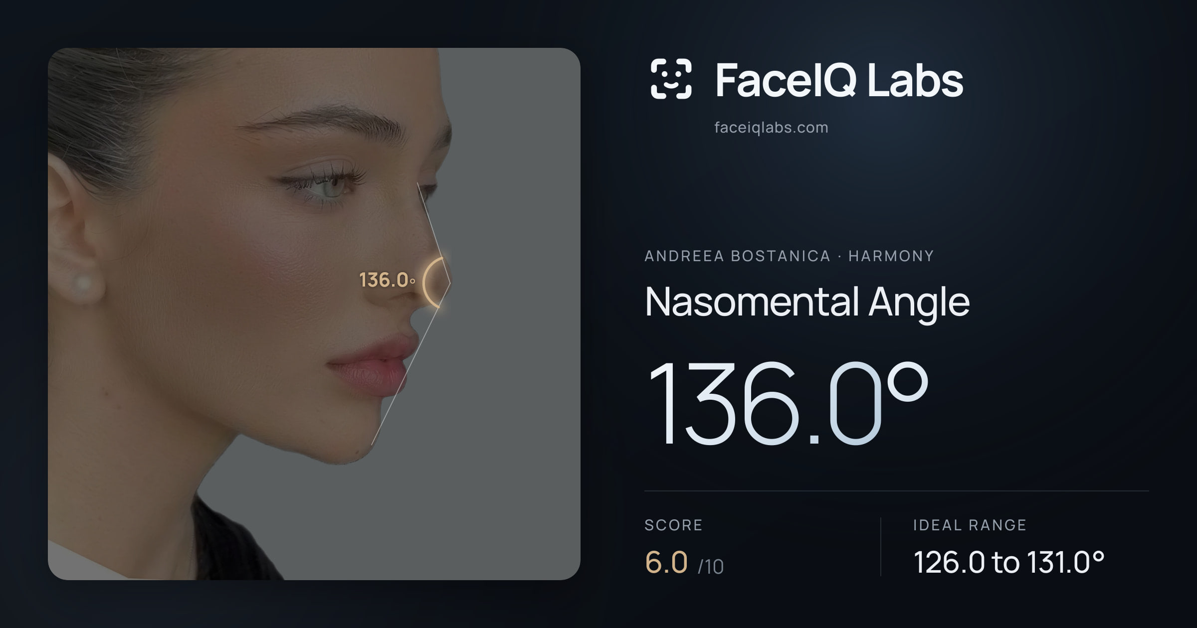 Andreea Bostanica Nasomental Angle: 136.0°, drawn on the photo