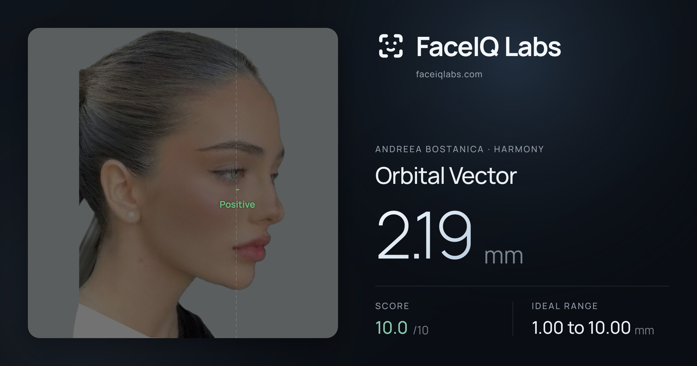 Andreea Bostanica Orbital Vector: 2.19mm, drawn on the photo