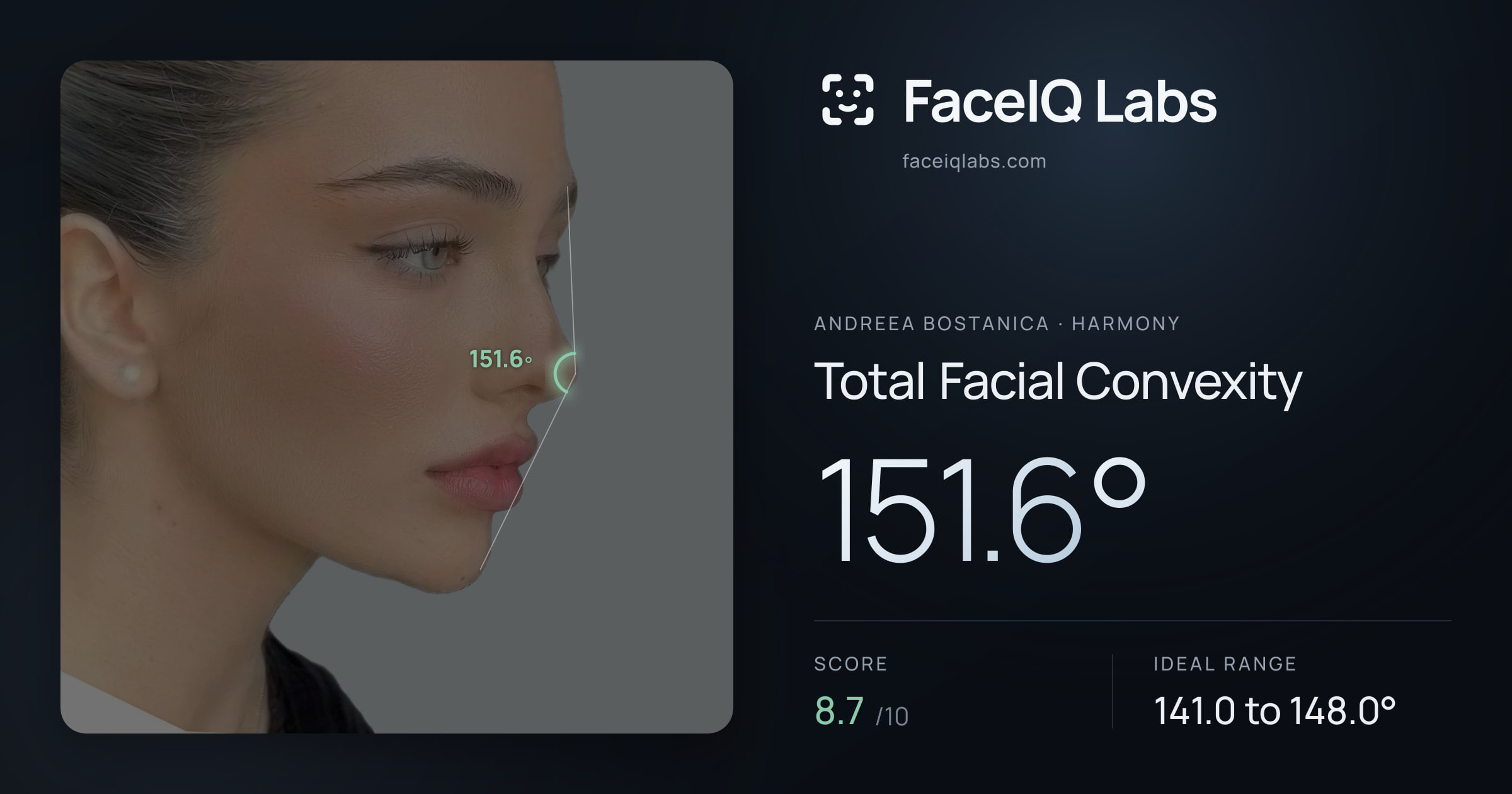 Andreea Bostanica Total Facial Convexity: 151.6°, drawn on the photo