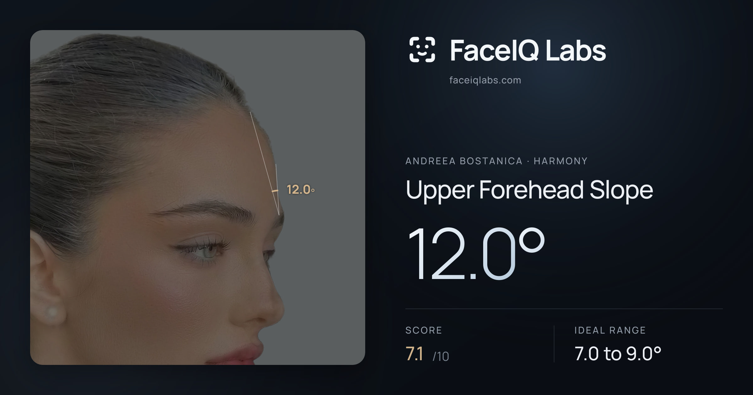 Andreea Bostanica Upper Forehead Slope: 12.0°, drawn on the photo
