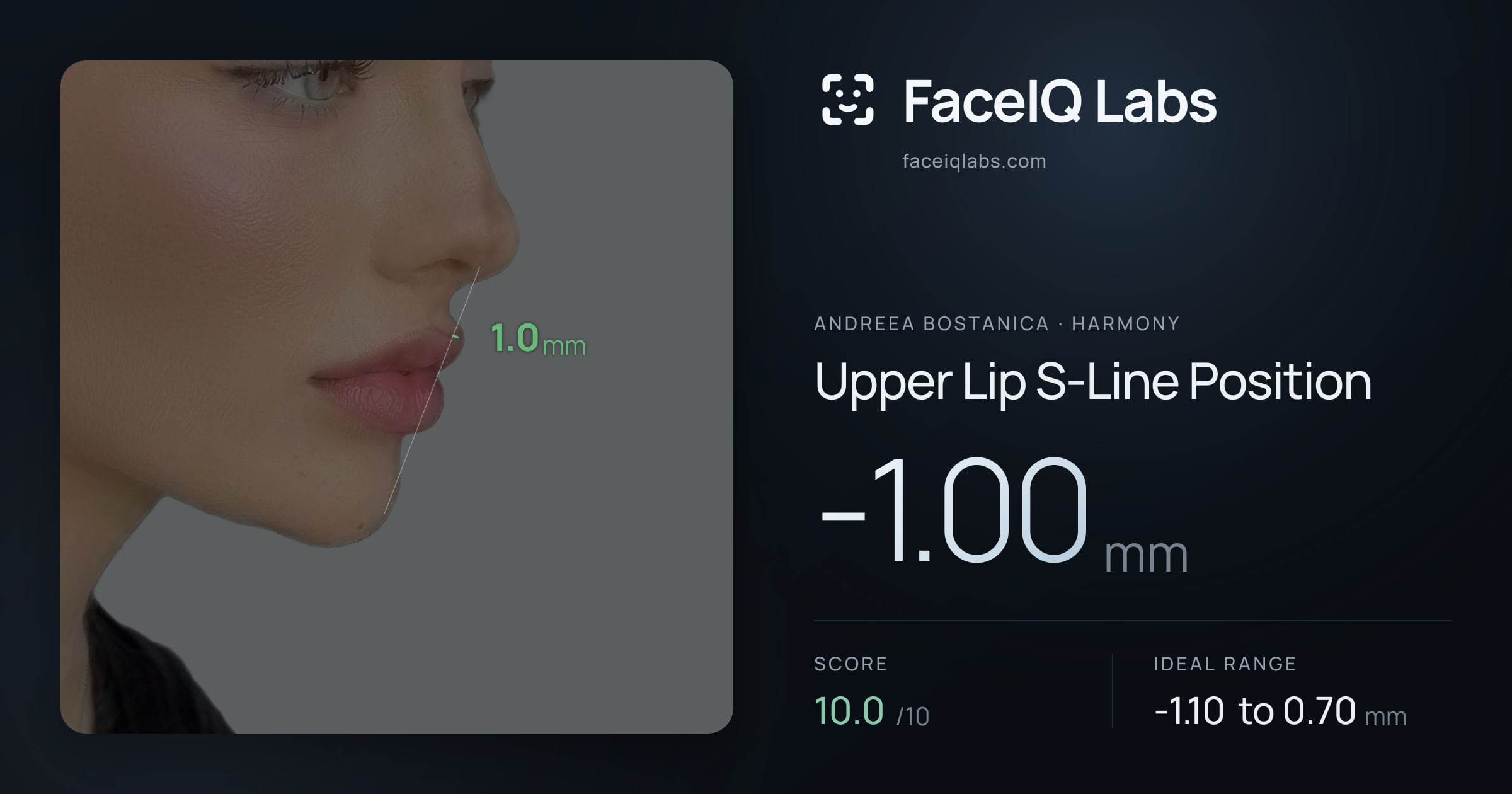 Andreea Bostanica Upper Lip S-Line Position: -1.00mm, drawn on the photo