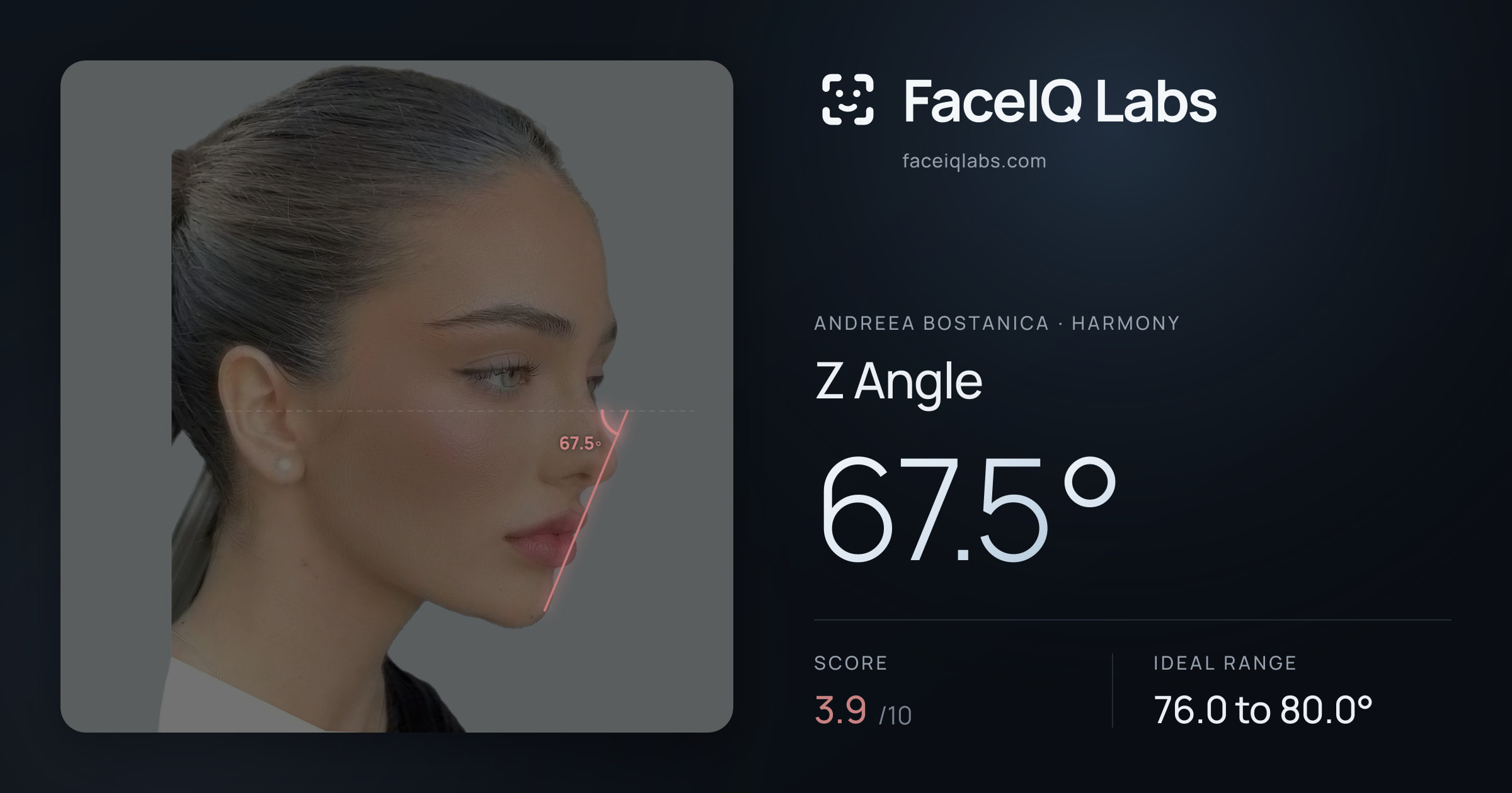 Andreea Bostanica Z Angle: 67.5°, drawn on the photo