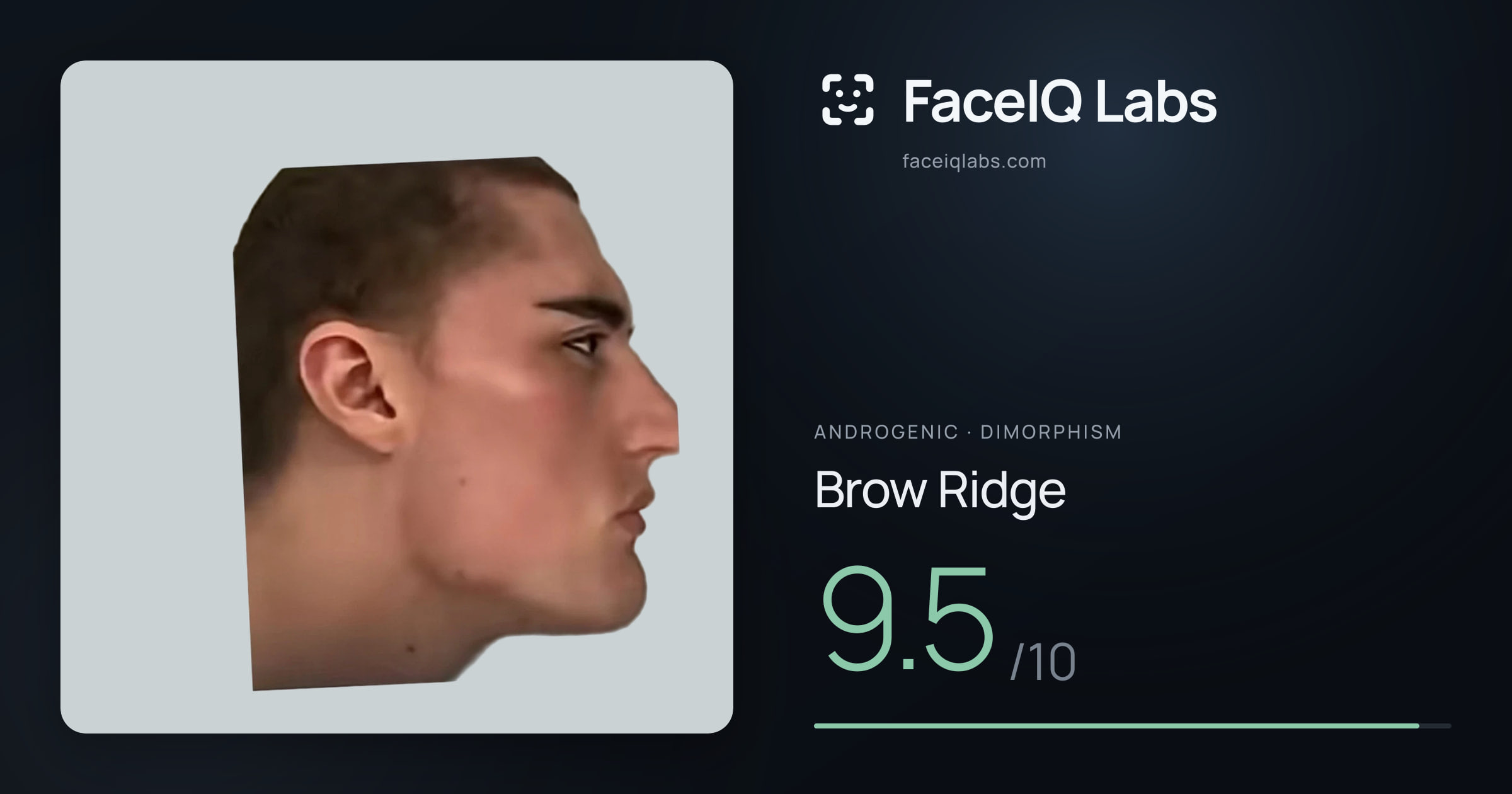 Androgenic Brow Ridge: 9.5/10, drawn on the photo