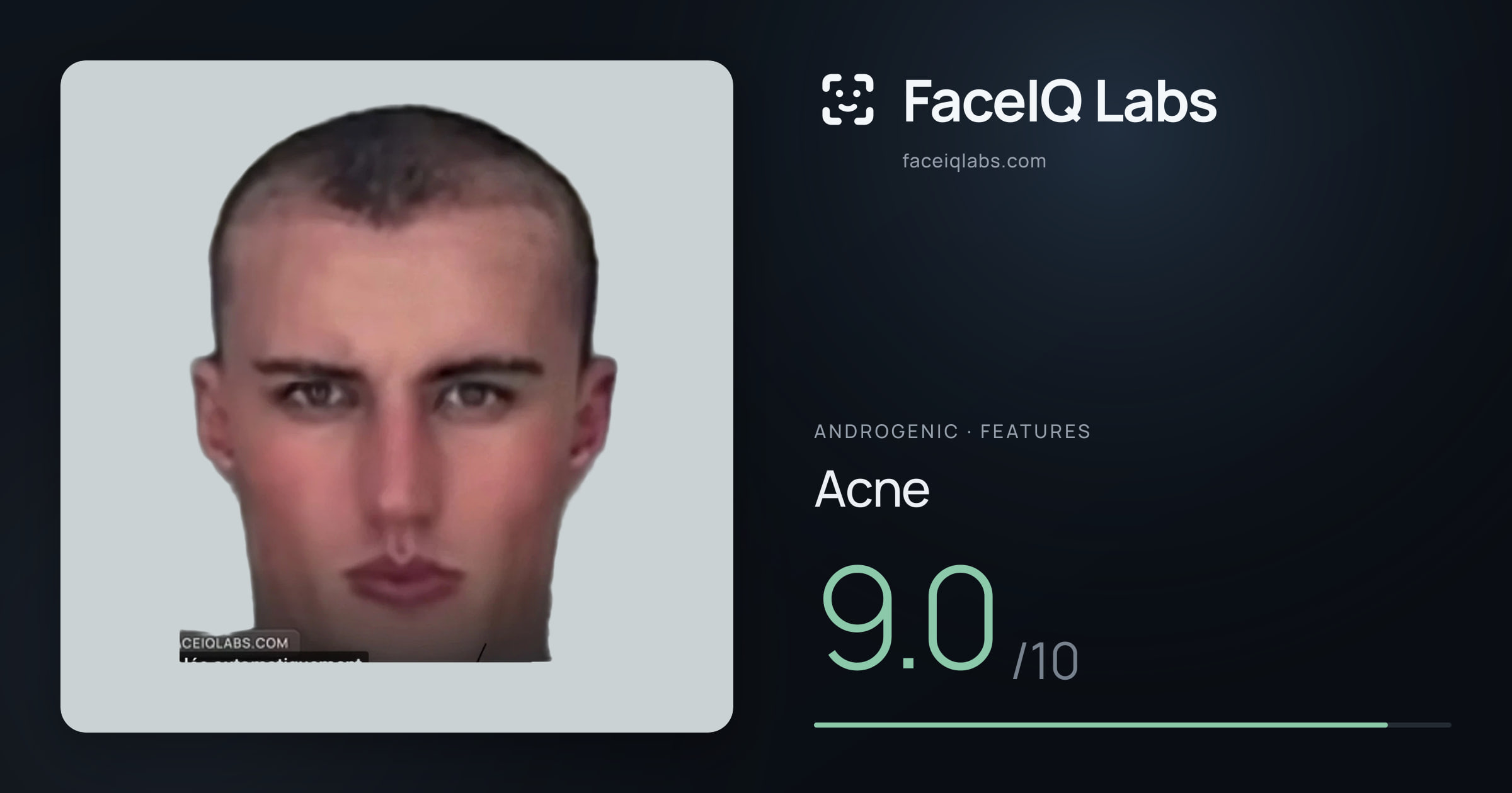 Androgenic Acne: 9.0/10, drawn on the photo