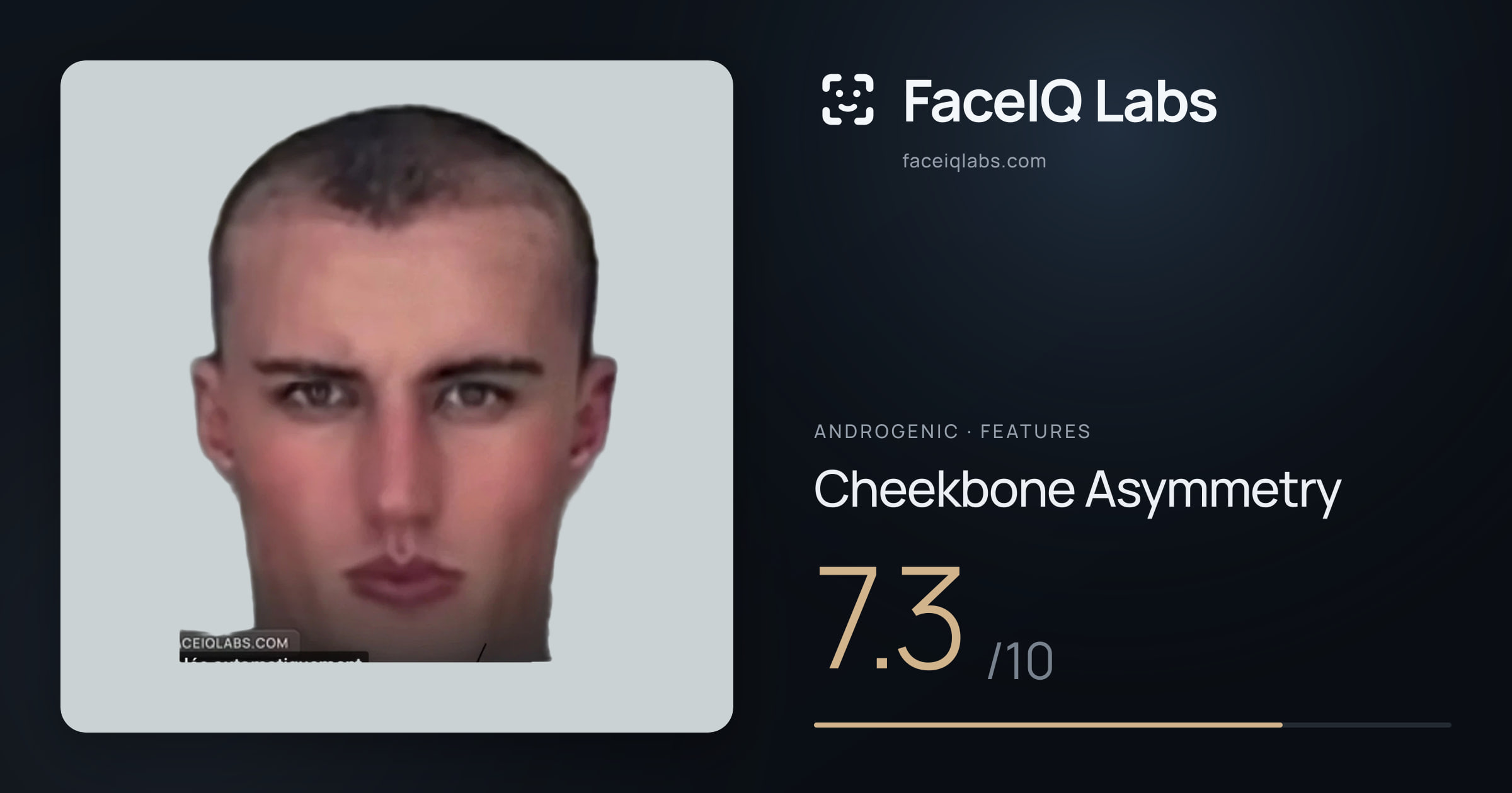 Androgenic Cheekbone Asymmetry: 7.3/10, drawn on the photo