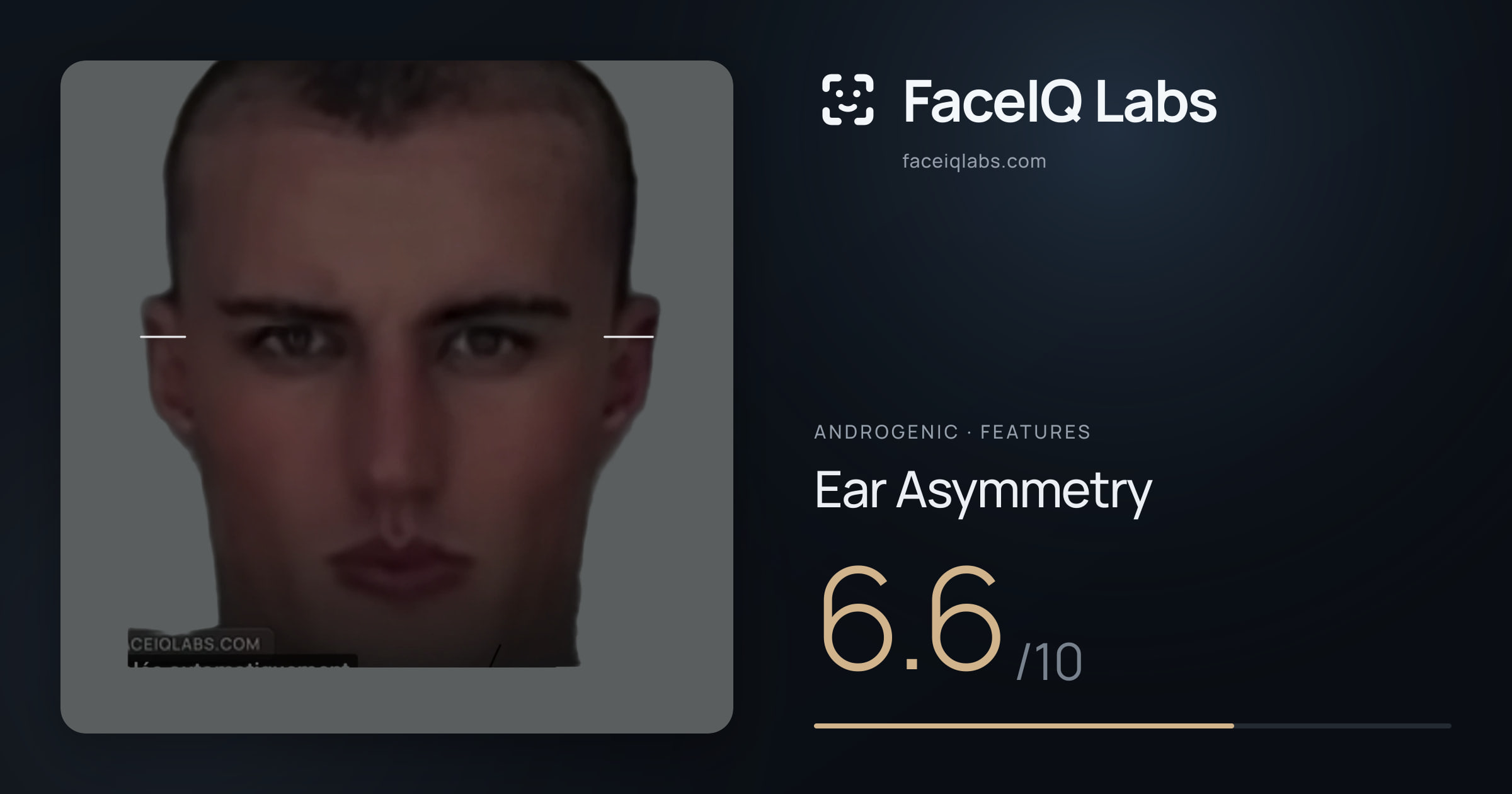 Androgenic Ear Asymmetry: 6.6/10, drawn on the photo
