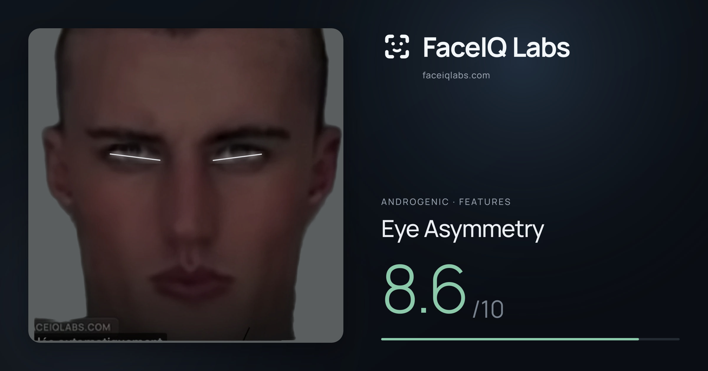 Androgenic Eye Asymmetry: 8.6/10, drawn on the photo