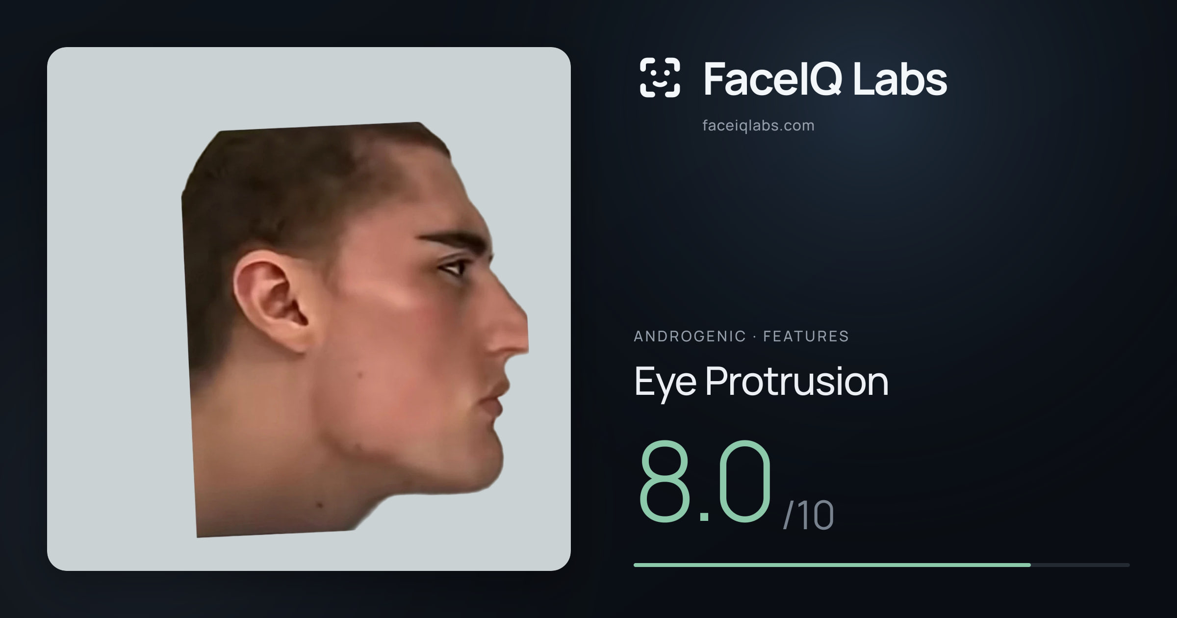 Androgenic Eye Protrusion: 8.0/10, drawn on the photo