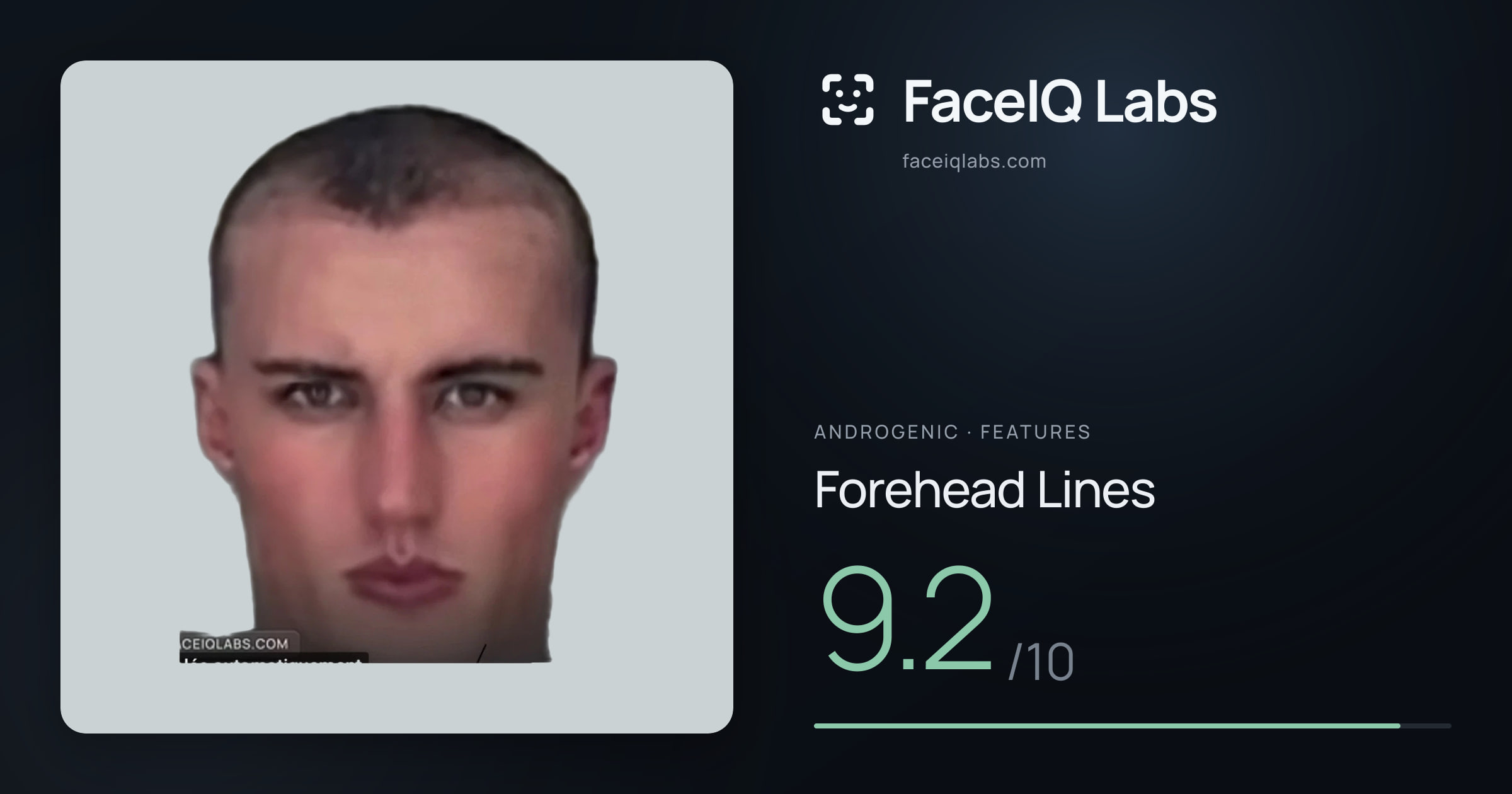 Androgenic Forehead Lines: 9.2/10, drawn on the photo