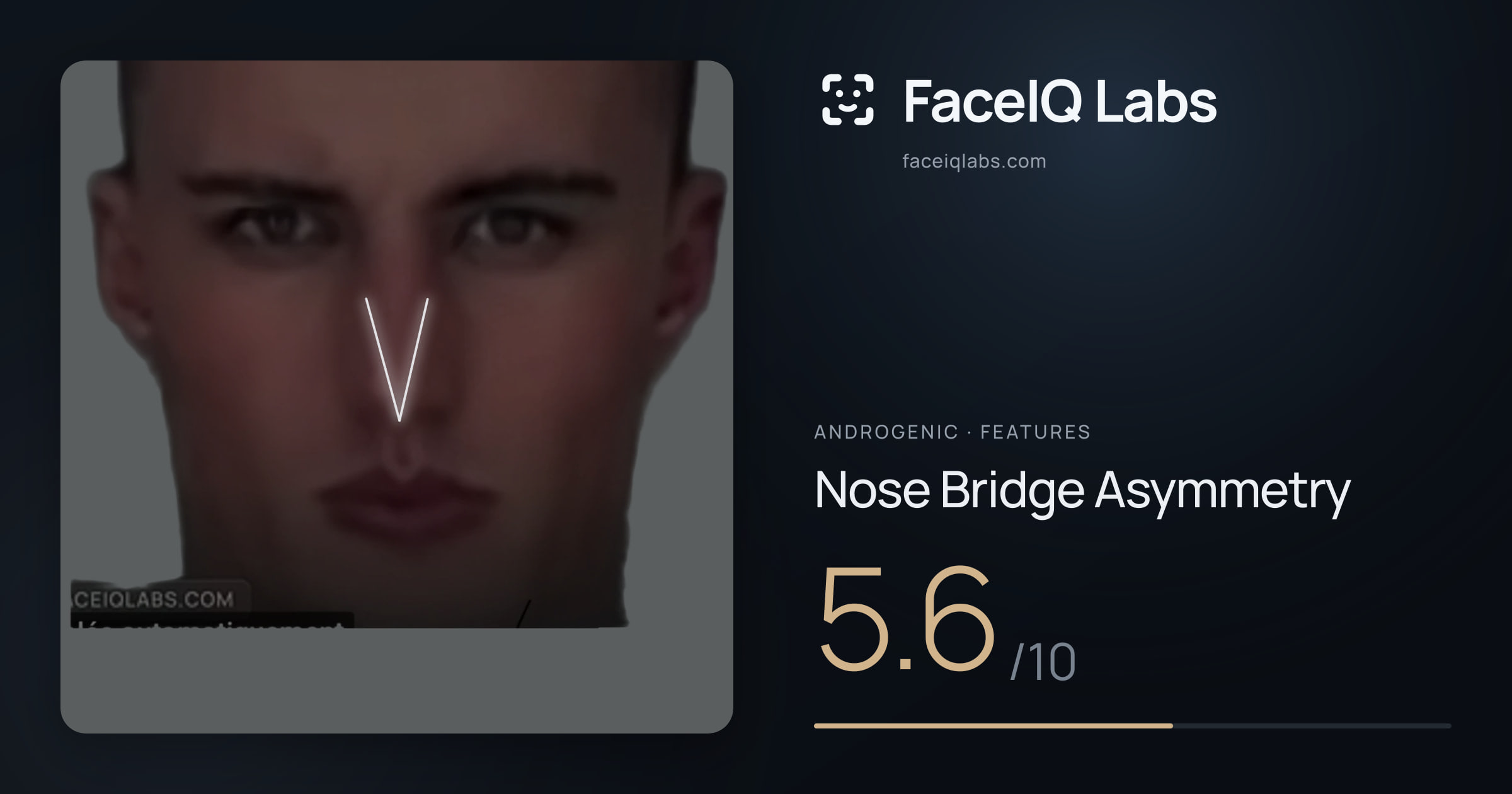 Androgenic Nose Bridge Asymmetry: 5.6/10, drawn on the photo