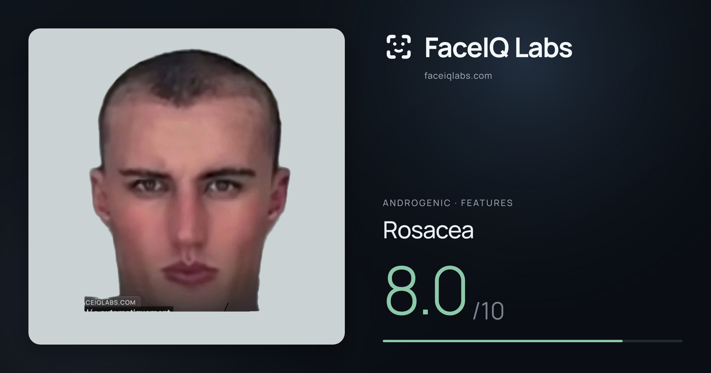 Androgenic Rosacea: 8.0/10, drawn on the photo