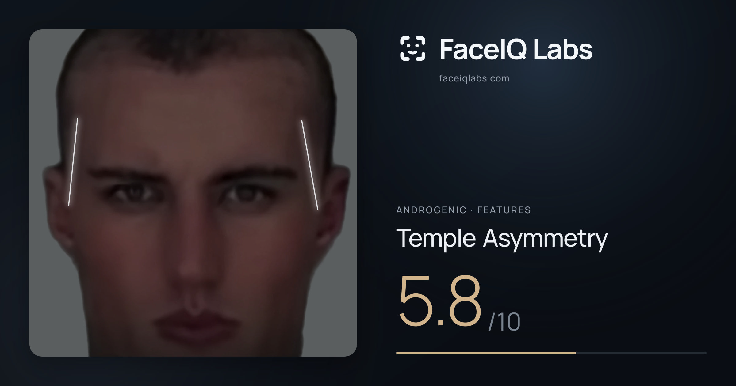 Androgenic Temple Asymmetry: 5.8/10, drawn on the photo