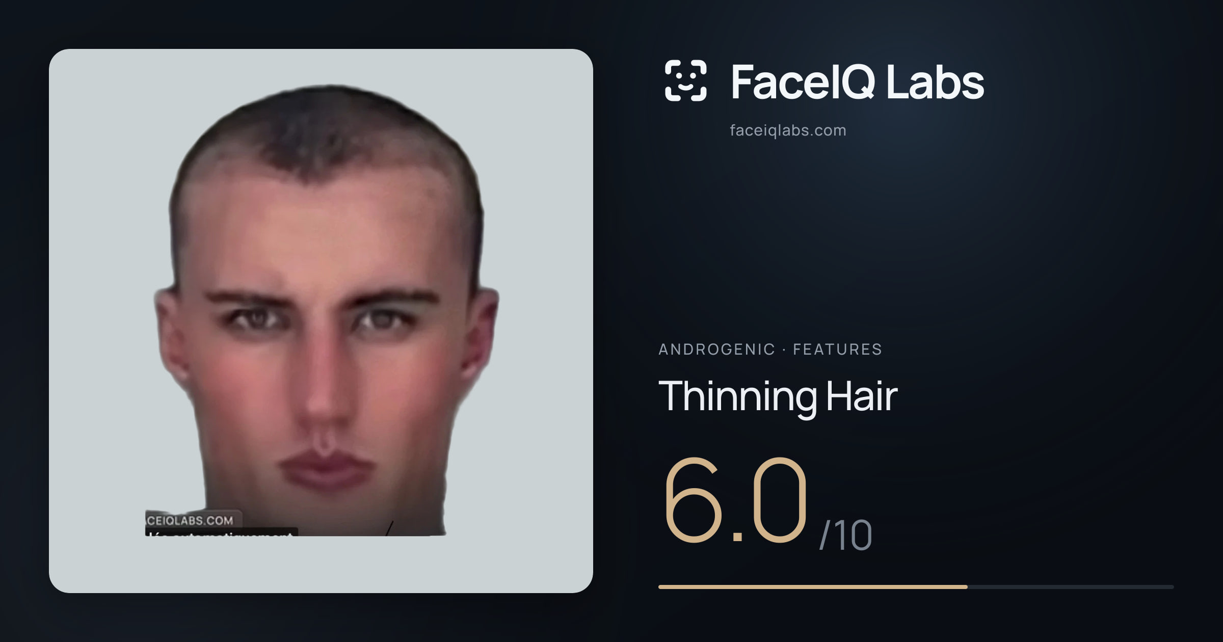 Androgenic Thinning Hair: 6.0/10, drawn on the photo