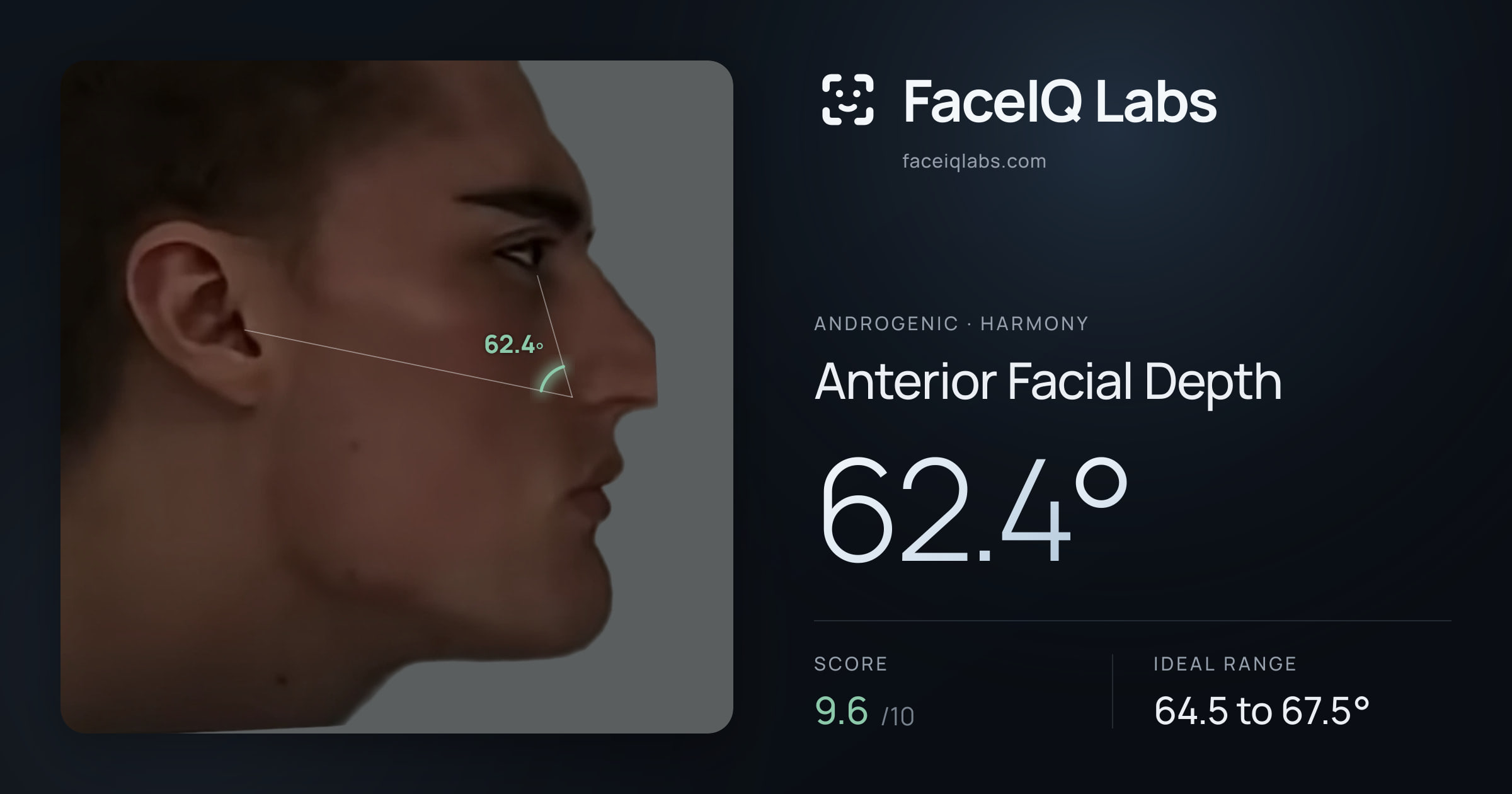 Androgenic Anterior Facial Depth: 62.4°, drawn on the photo