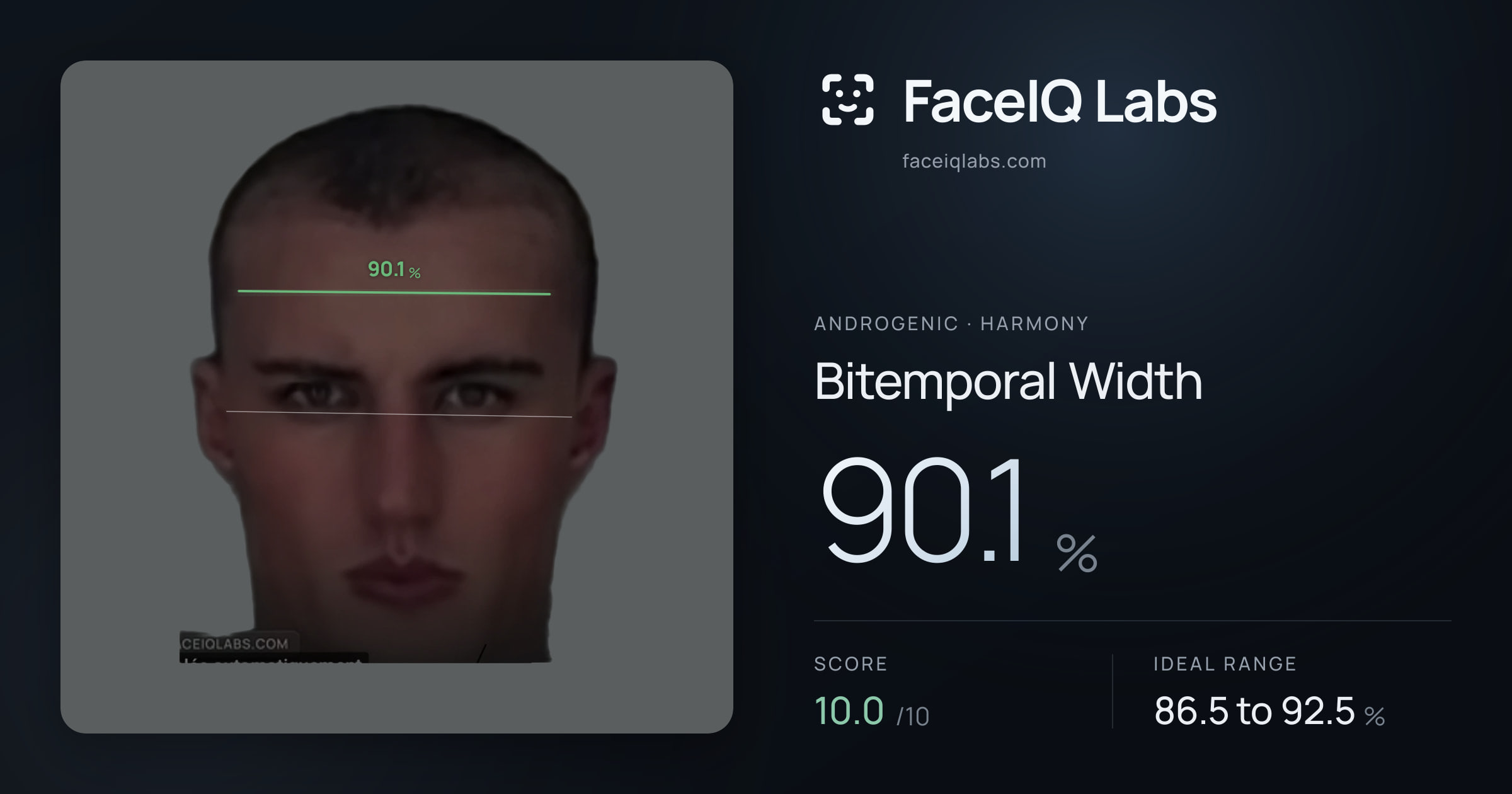 Androgenic Bitemporal Width: 90.1%, drawn on the photo