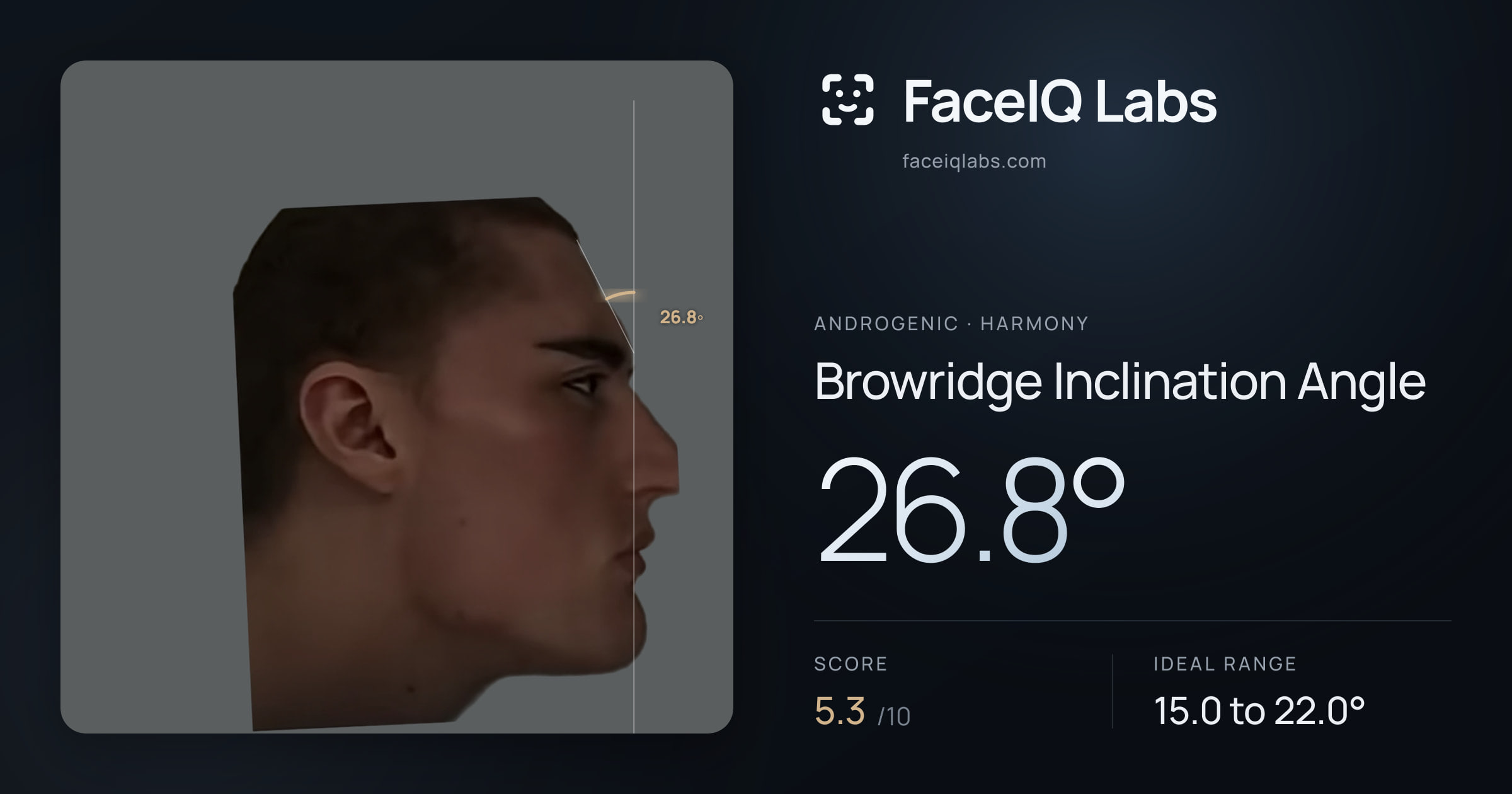 Androgenic Browridge Inclination Angle: 27.1°, drawn on the photo