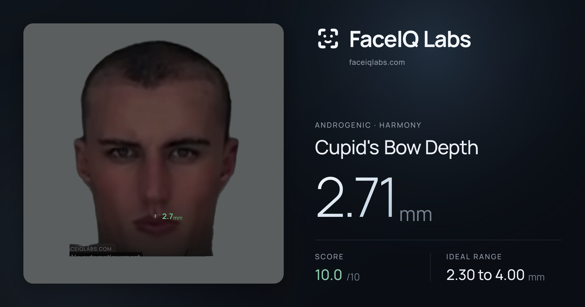 Androgenic Cupid's Bow Depth: 2.71mm, drawn on the photo