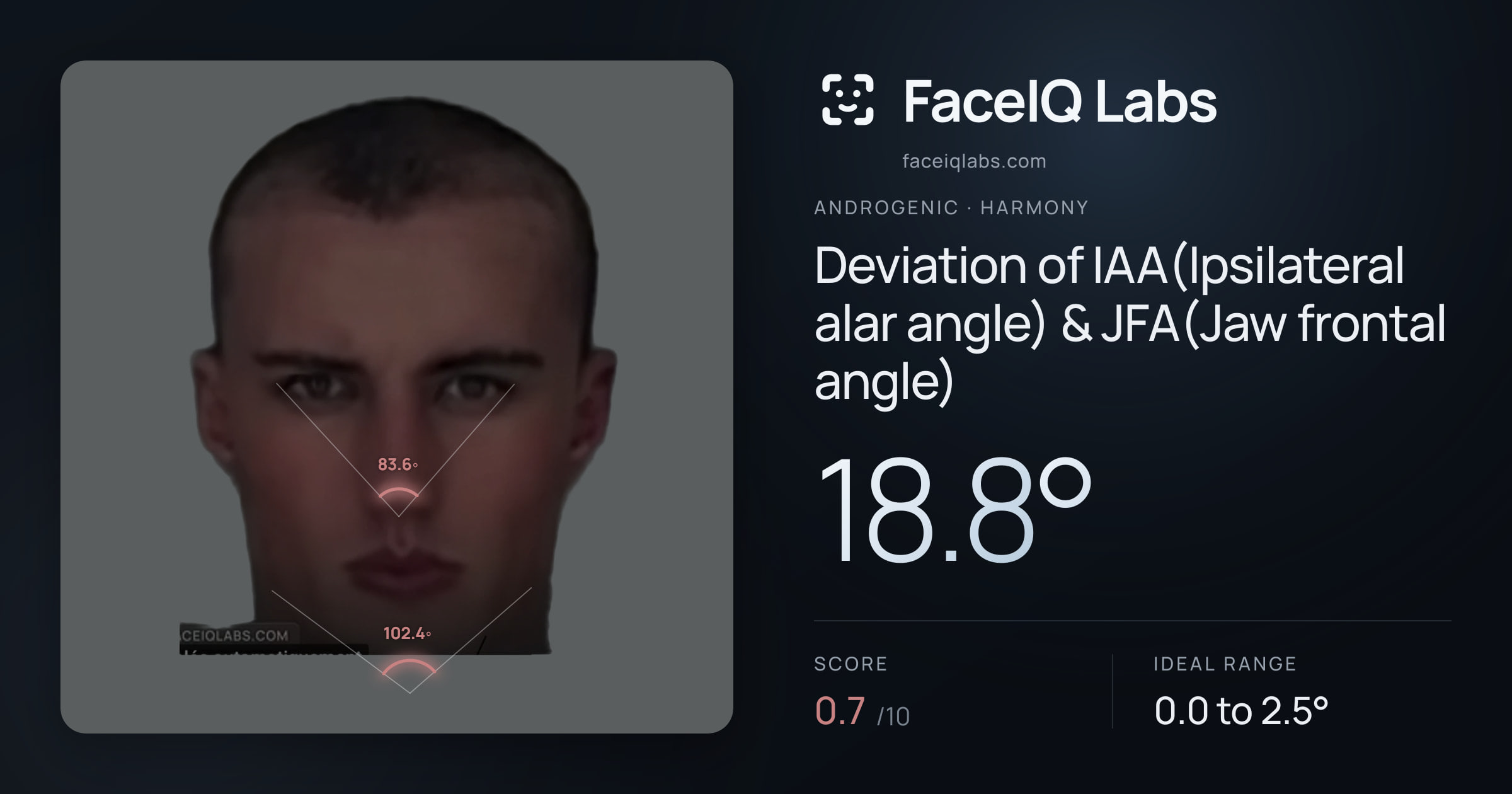 Androgenic Deviation of IAA(Ipsilateral alar angle) & JFA(Jaw frontal angle): 18.8°, drawn on the photo