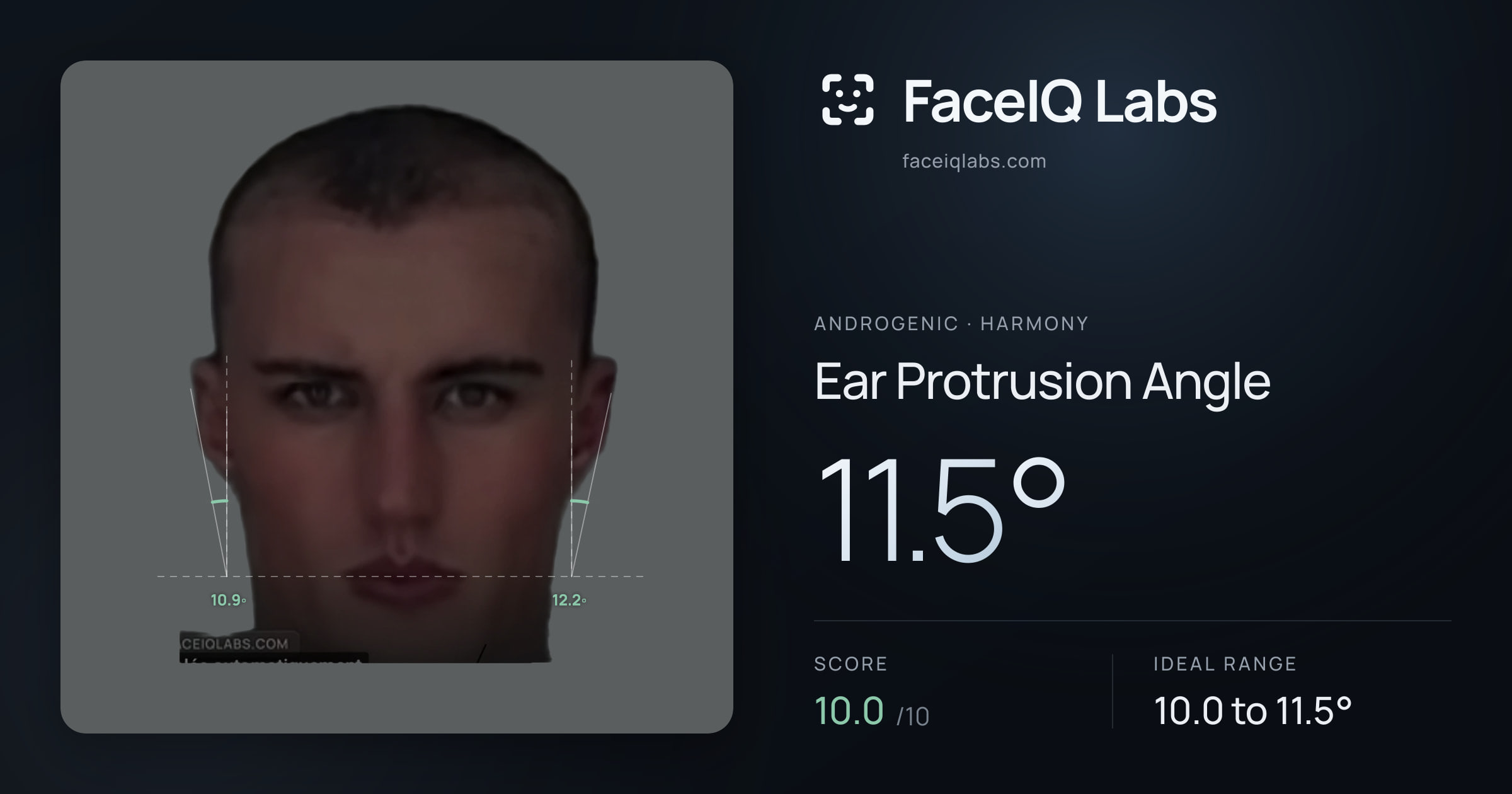 Androgenic Ear Protrusion Angle: 11.5°, drawn on the photo
