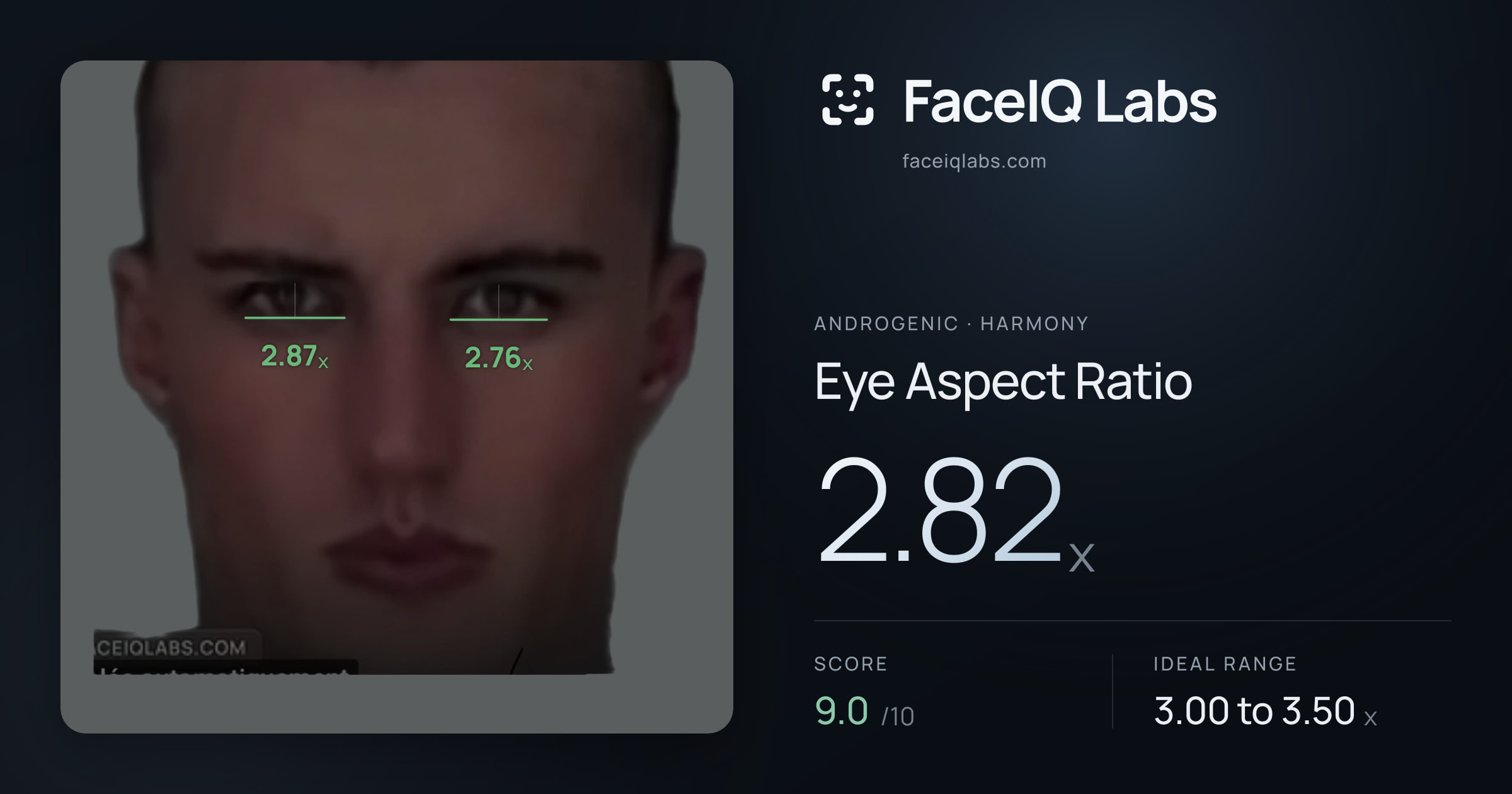 Androgenic Eye Aspect Ratio: 2.82x, drawn on the photo