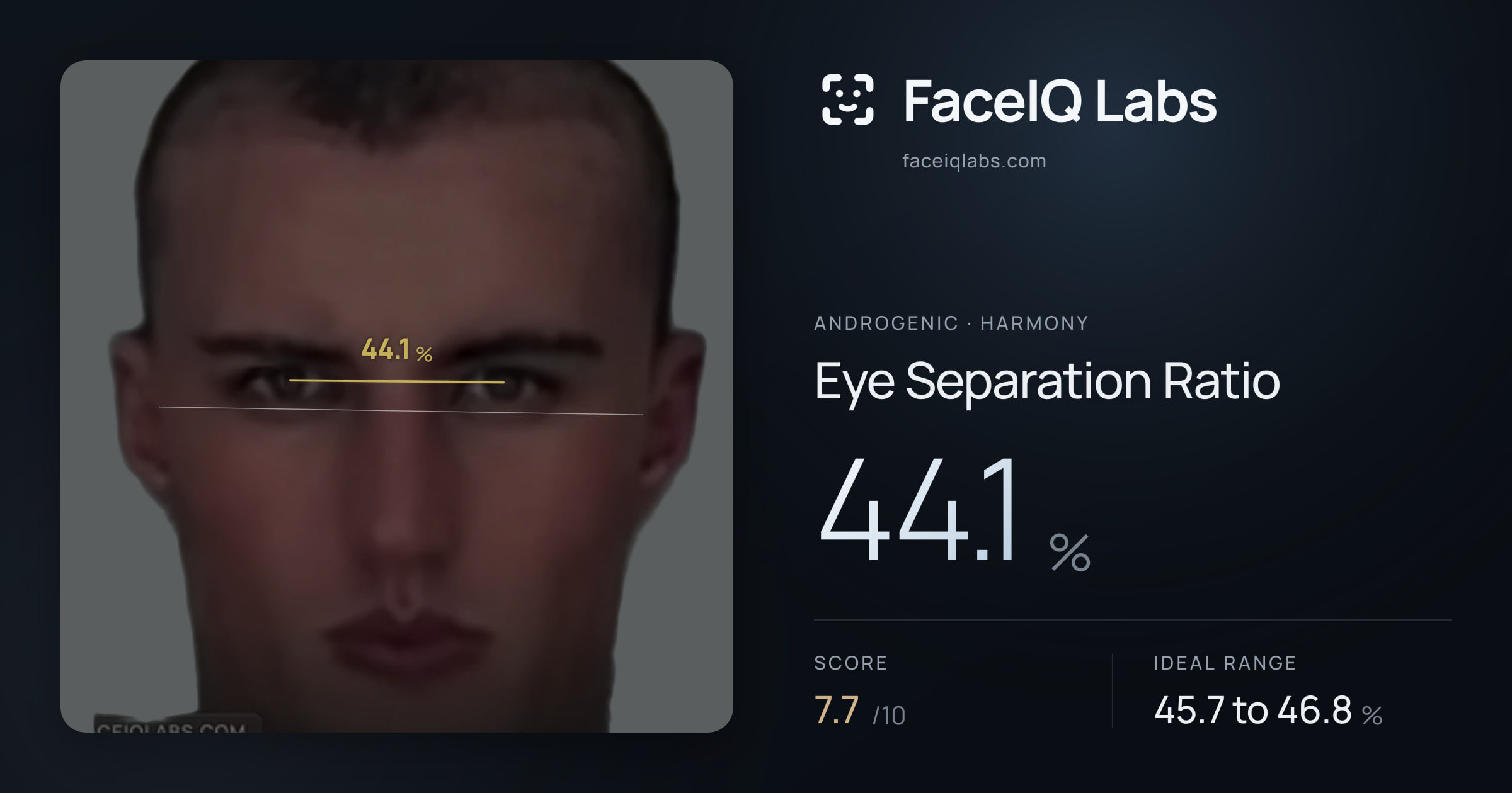 Androgenic Eye Separation Ratio: 44.1%, drawn on the photo