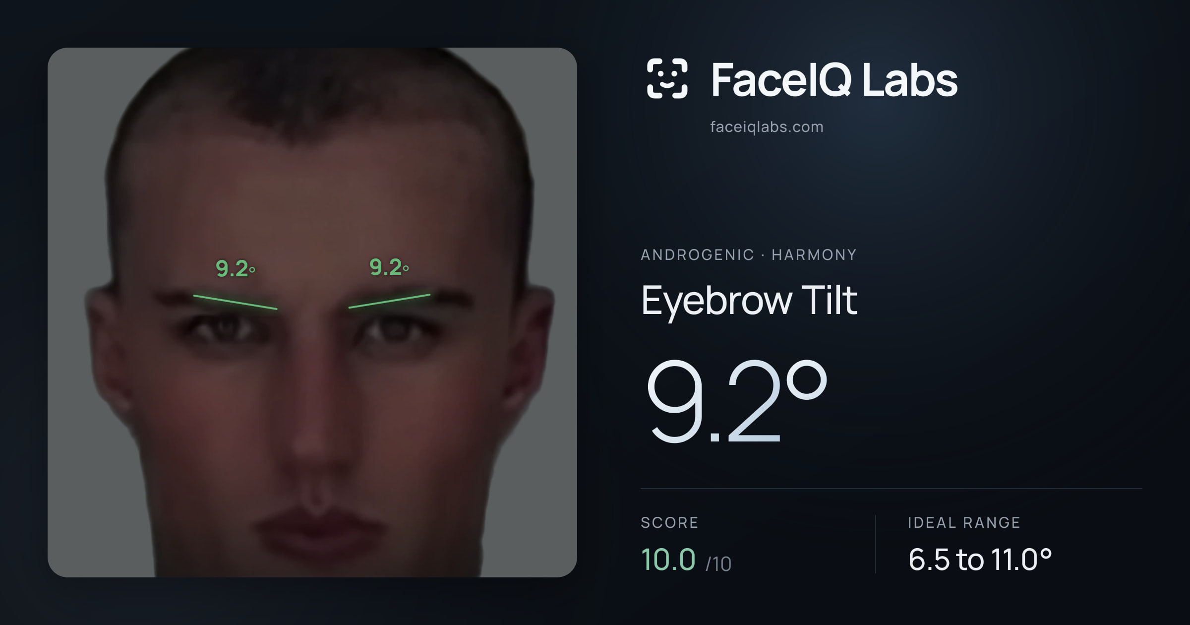 Androgenic Eyebrow Tilt: 9.2°, drawn on the photo
