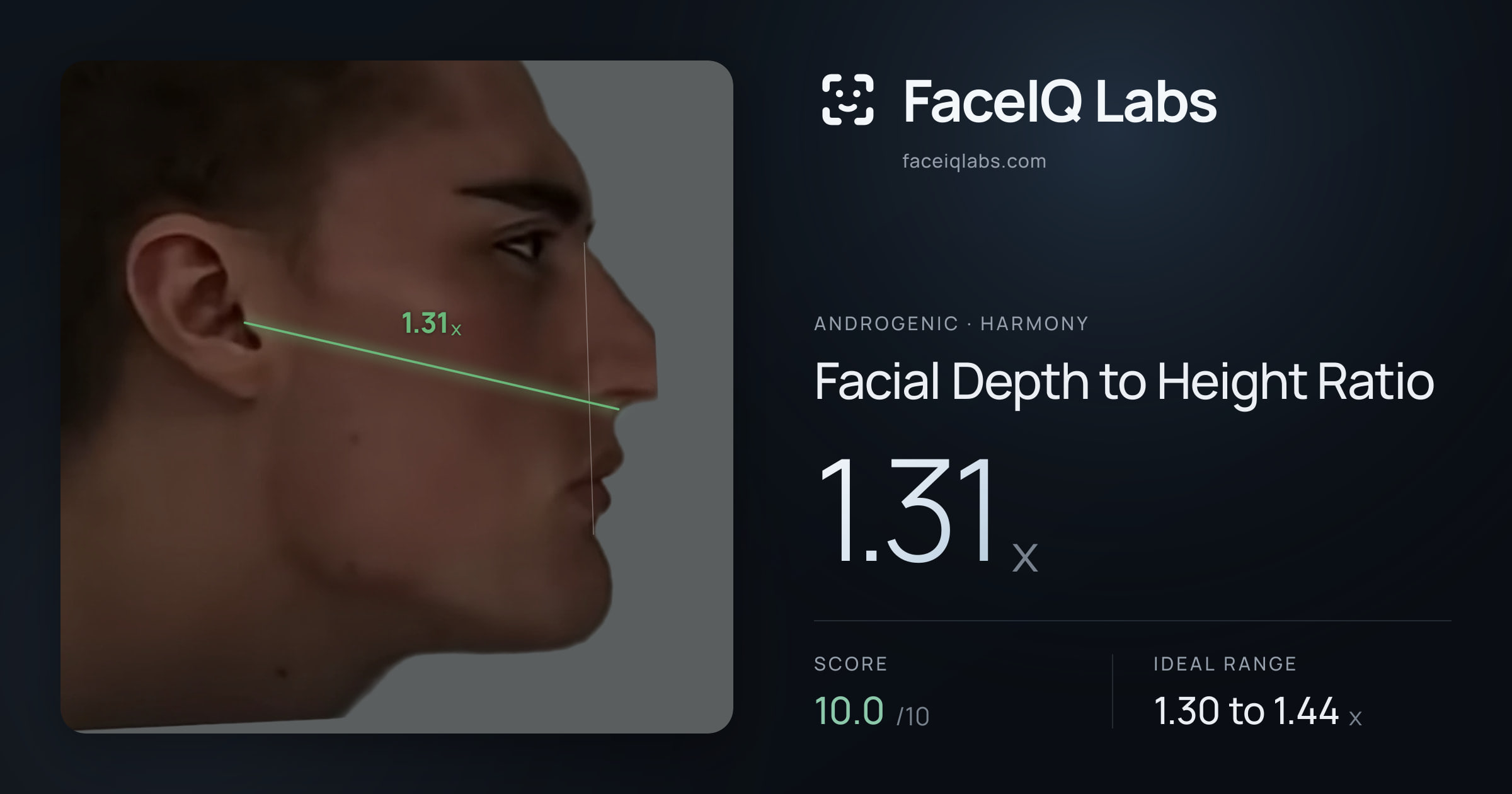 Androgenic Facial Depth to Height Ratio: 1.31x, drawn on the photo