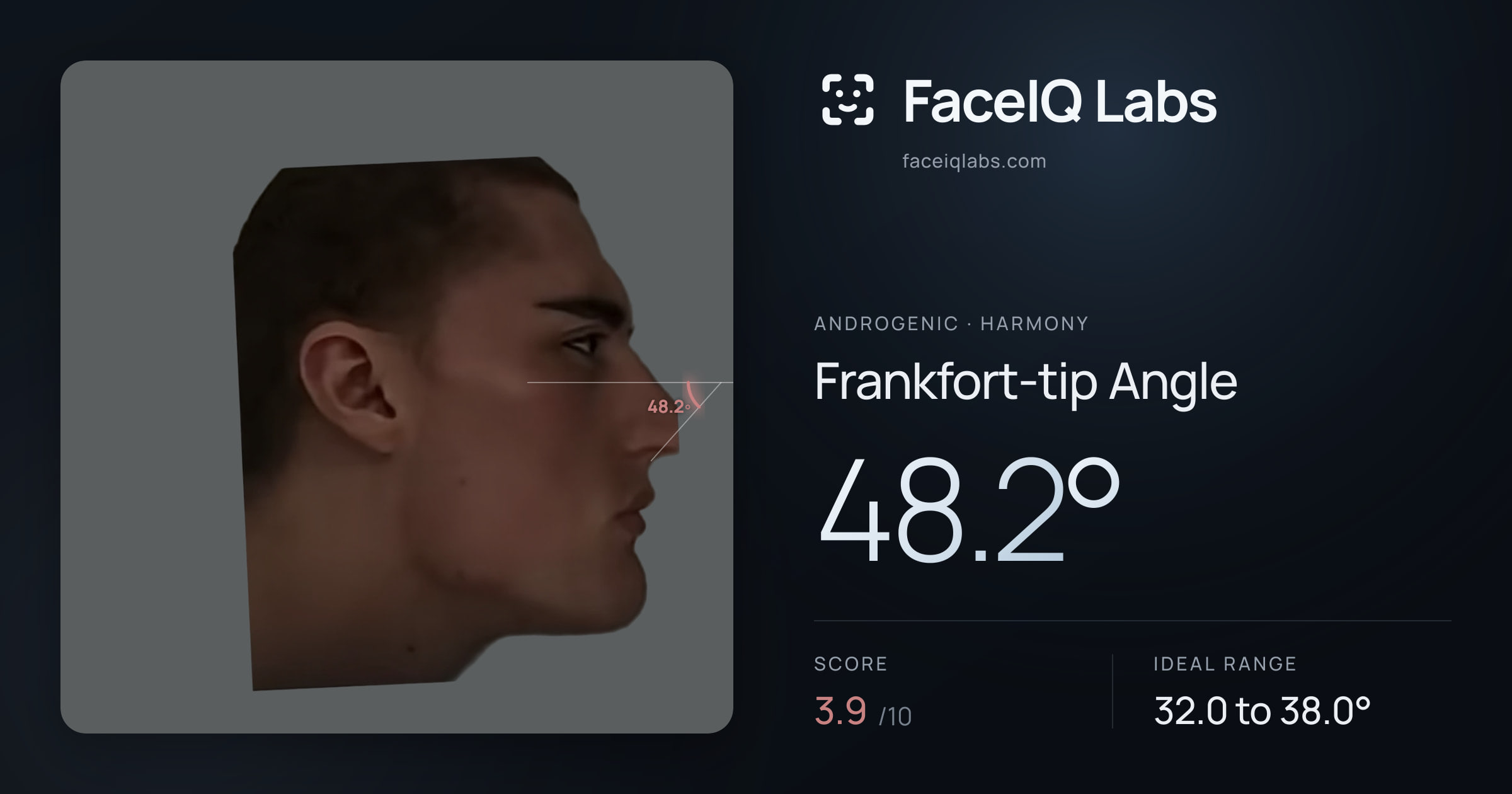 Androgenic Frankfort-tip Angle: 48.2°, drawn on the photo