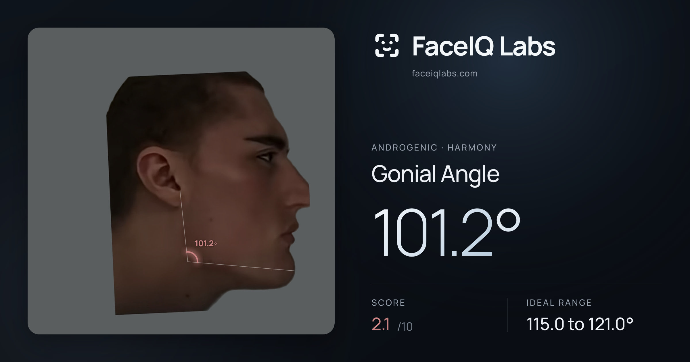 Androgenic Gonial Angle: 102.4°, drawn on the photo