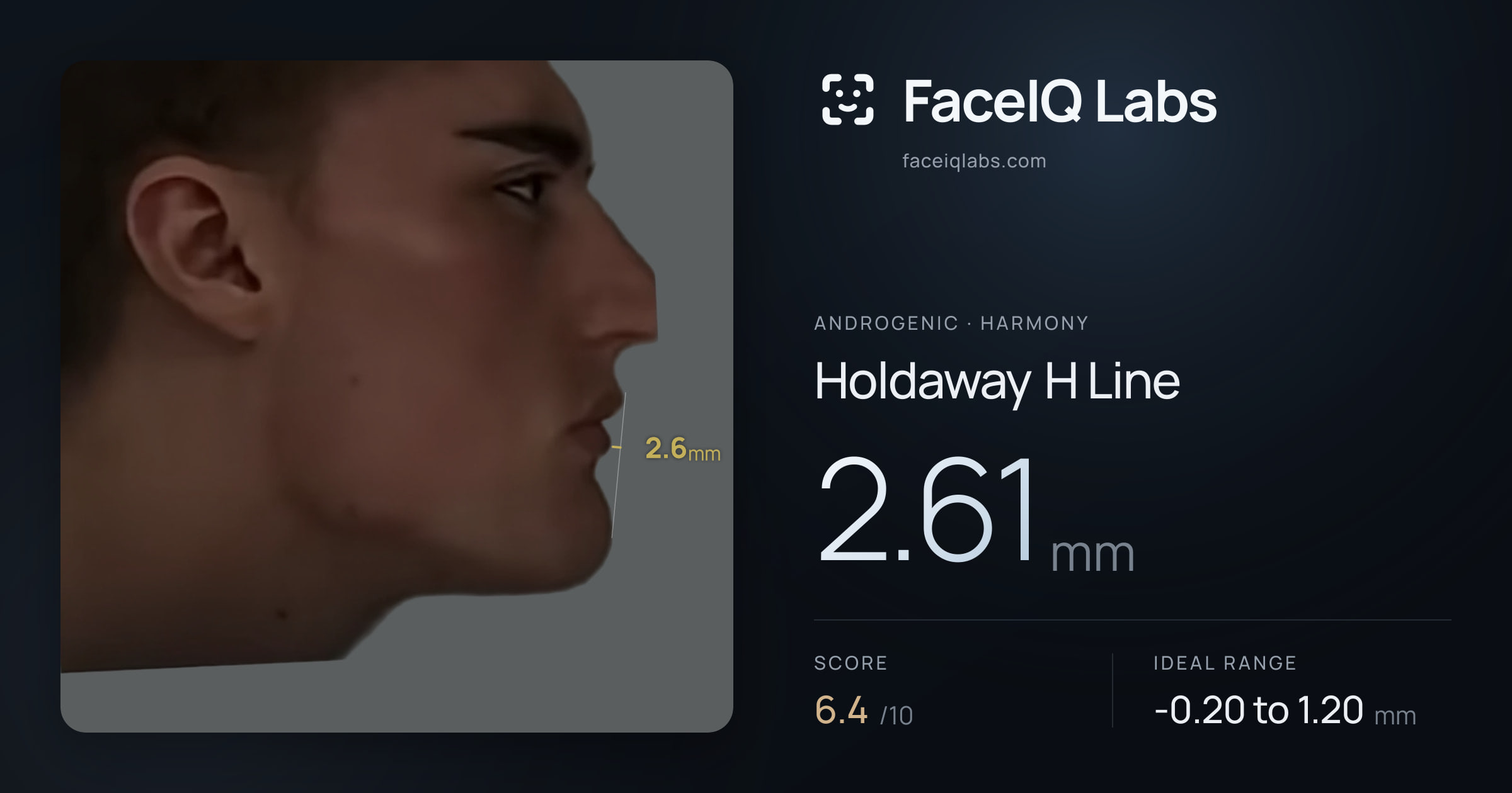 Androgenic Holdaway H Line: 2.61mm, drawn on the photo