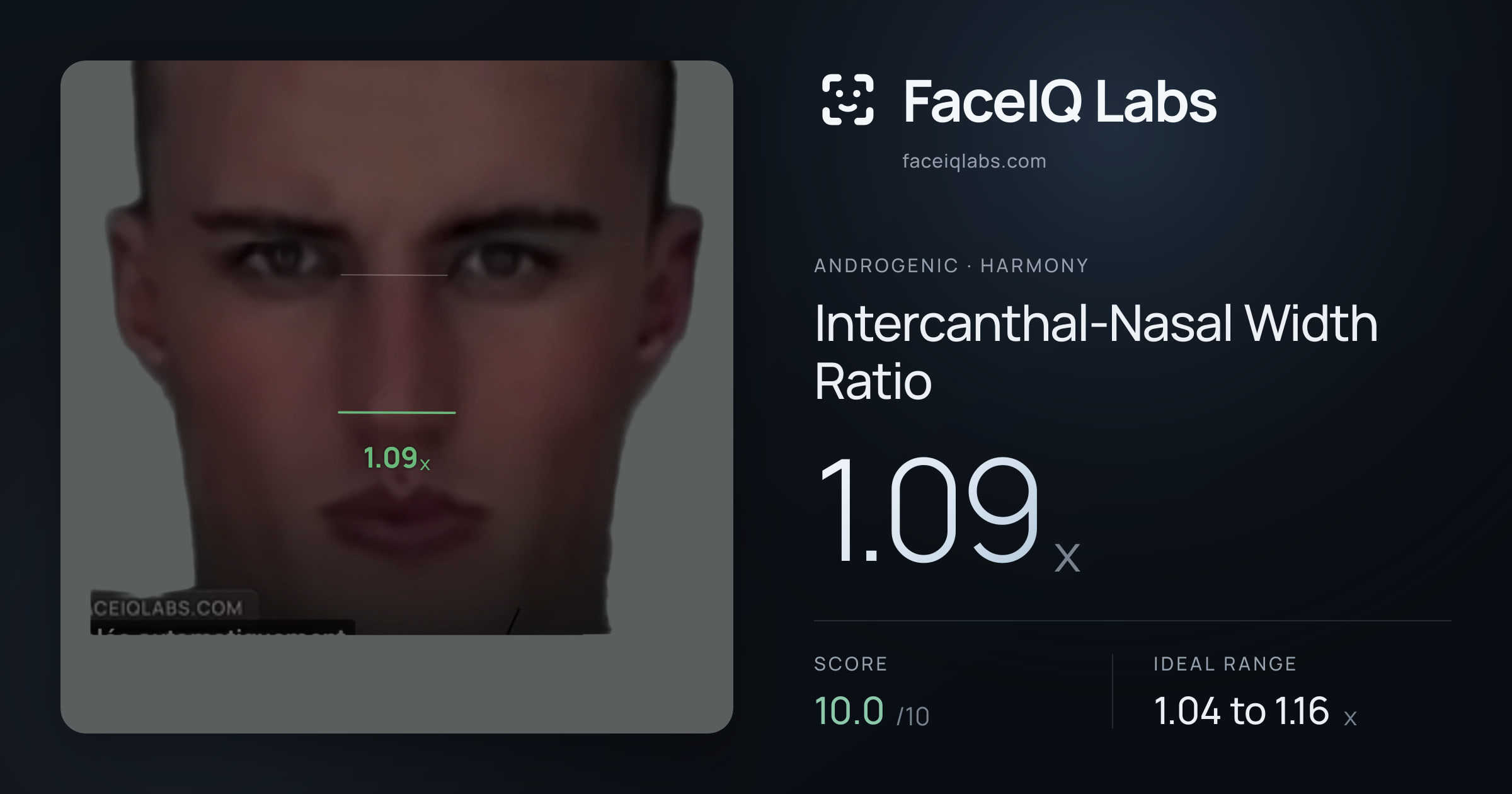 Androgenic Intercanthal-Nasal Width Ratio: 1.09x, drawn on the photo