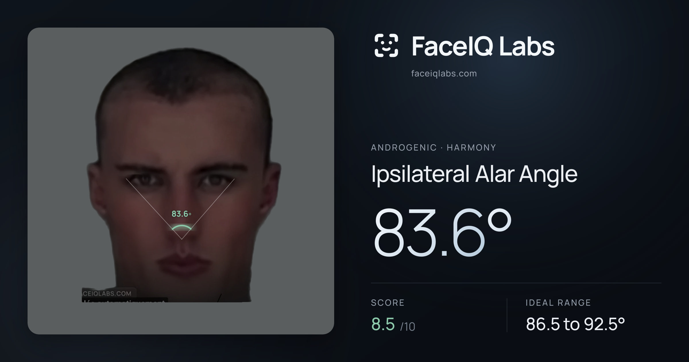 Androgenic Ipsilateral Alar Angle: 83.6°, drawn on the photo