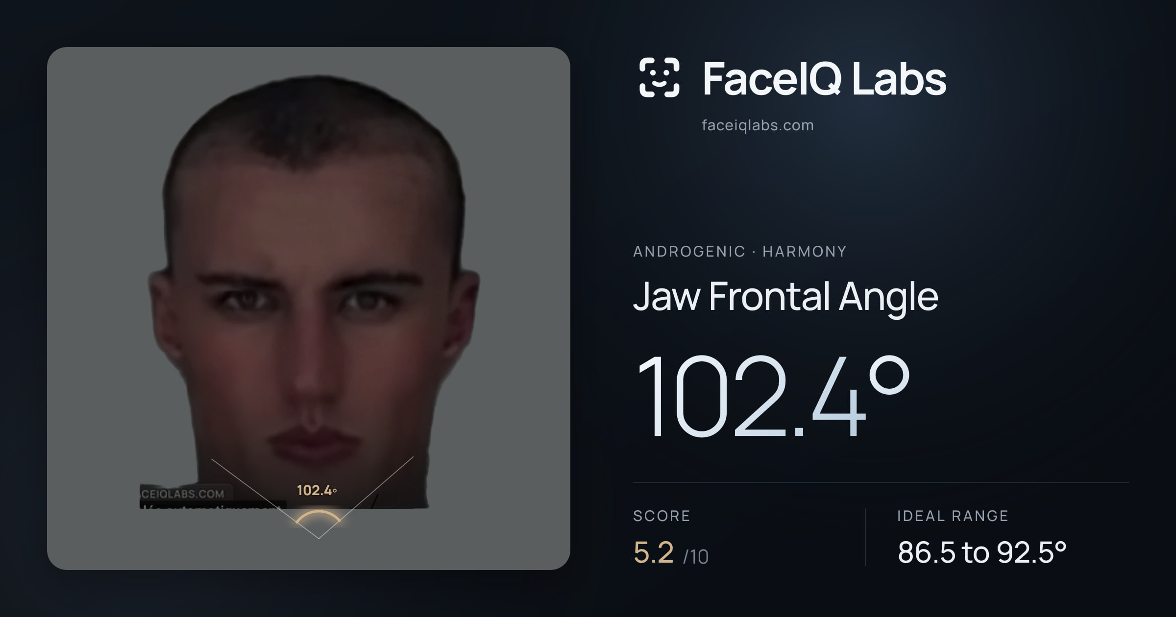 Androgenic Jaw Frontal Angle: 102.4°, drawn on the photo