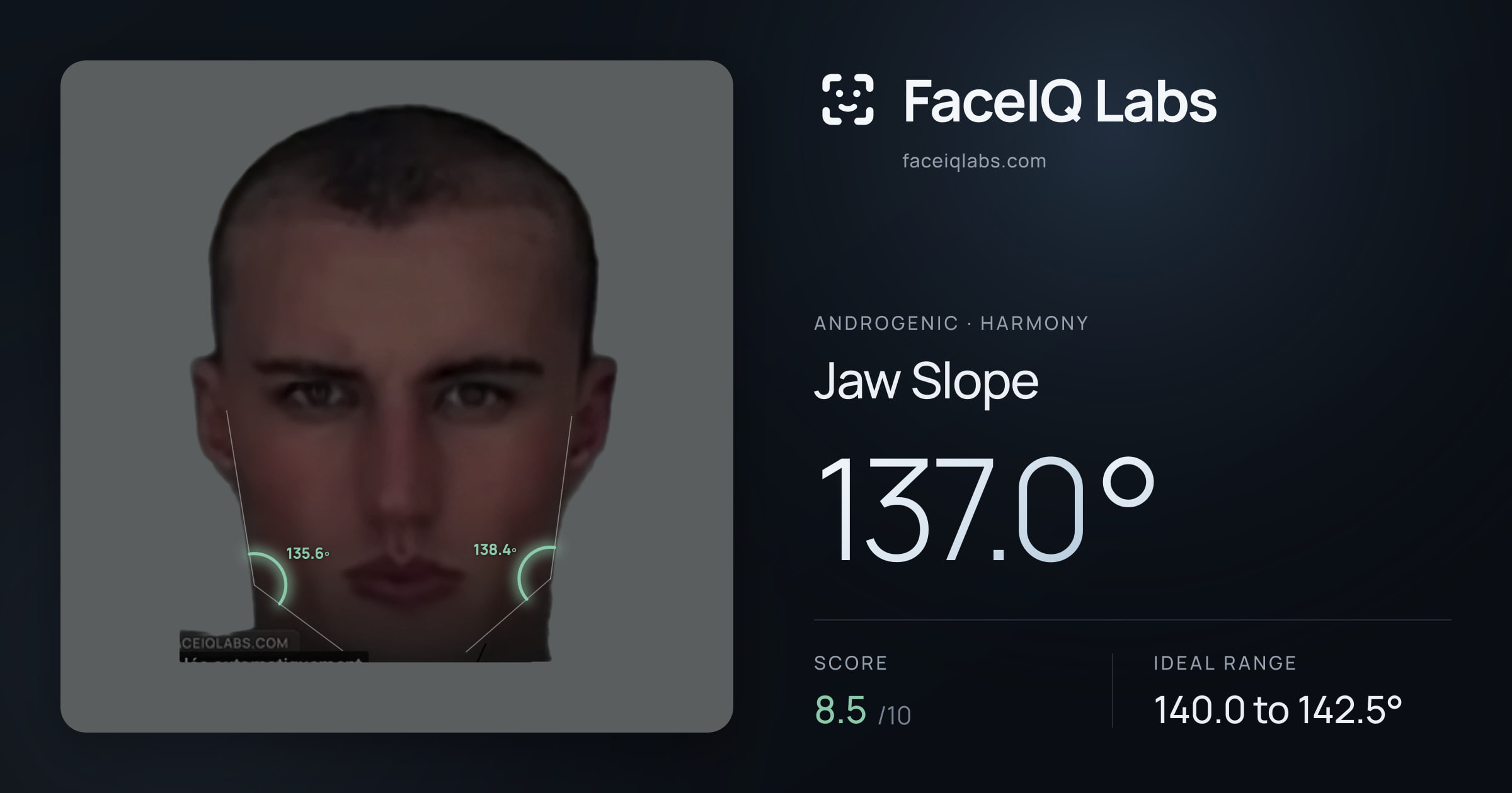 Androgenic Jaw Slope: 137.0°, drawn on the photo