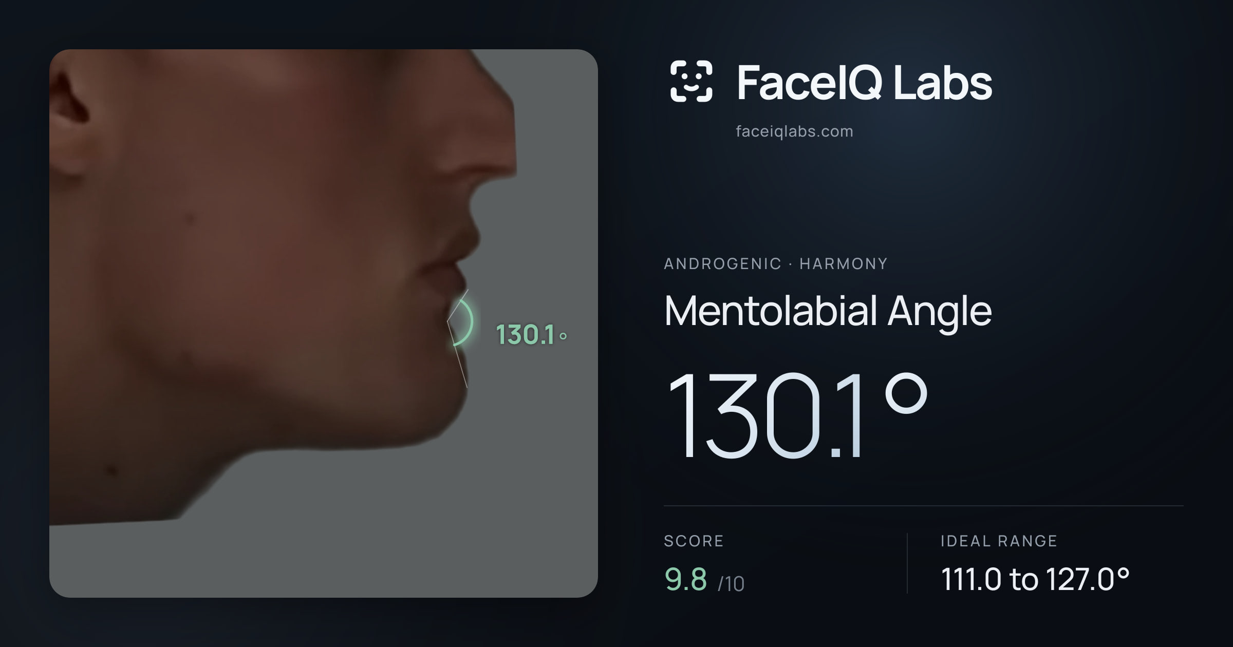 Androgenic Mentolabial Angle: 130.1°, drawn on the photo