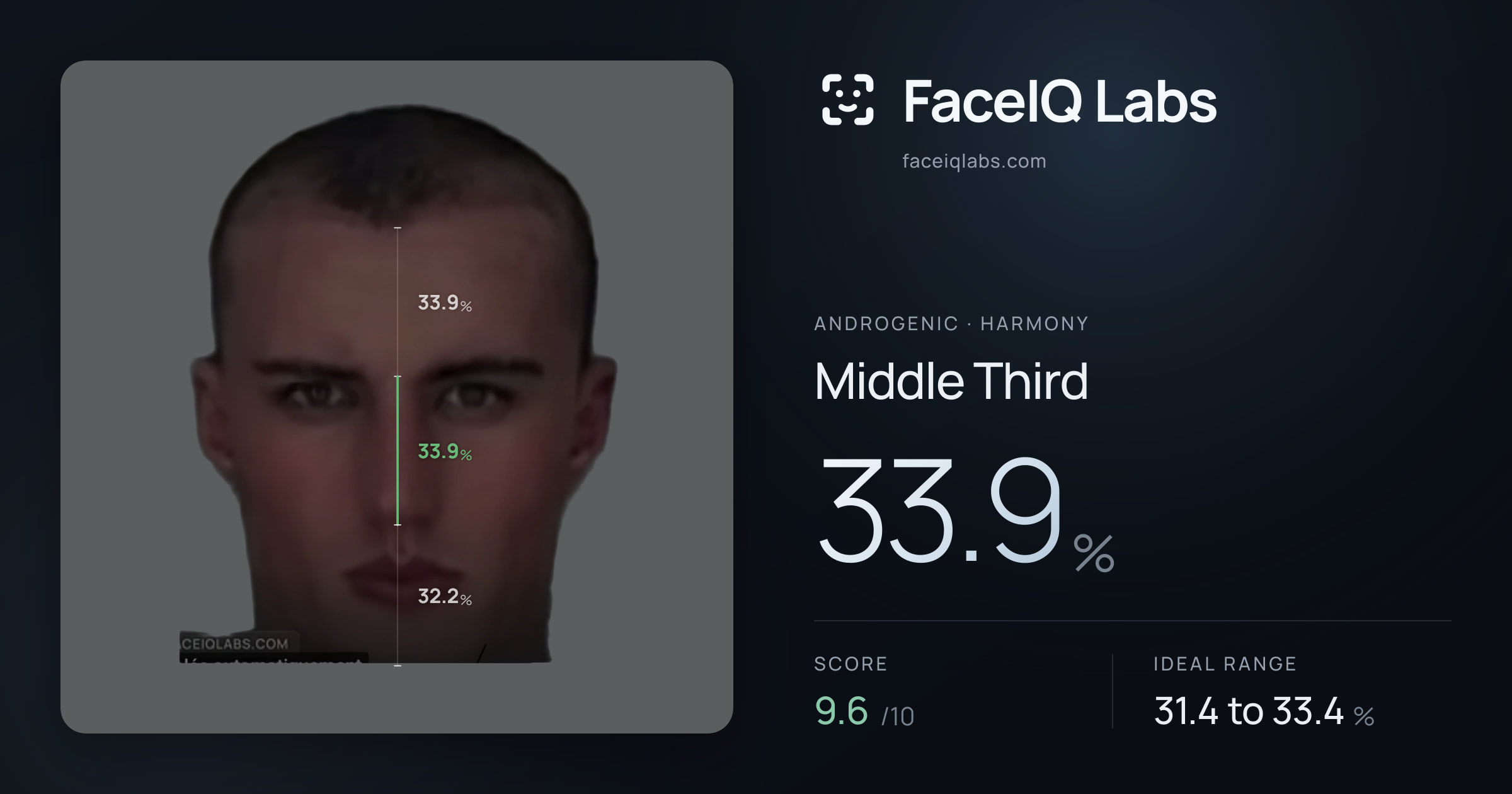 Androgenic Middle Third: 33.9%, drawn on the photo